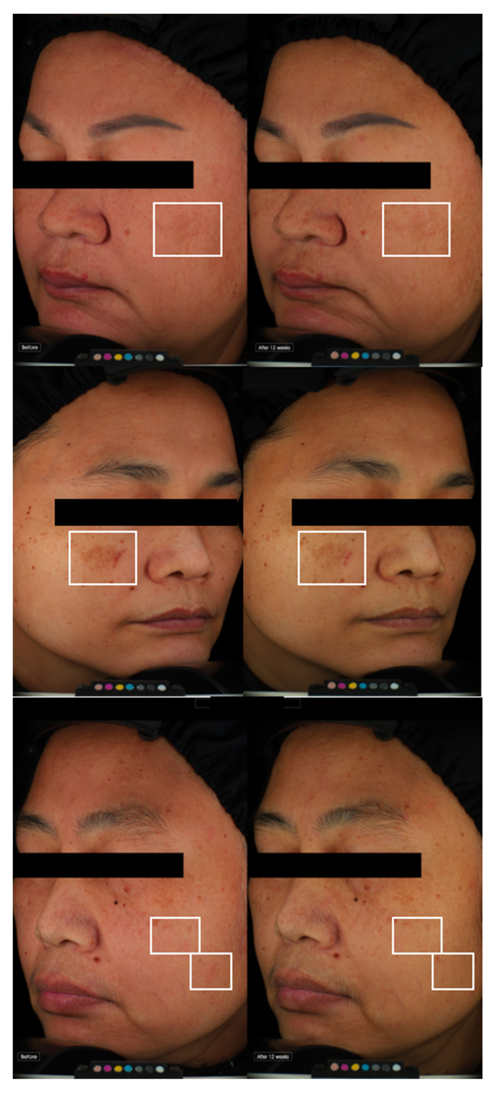 Cosmetics 10 00143 g005 Cosmetics 10 00143 g005