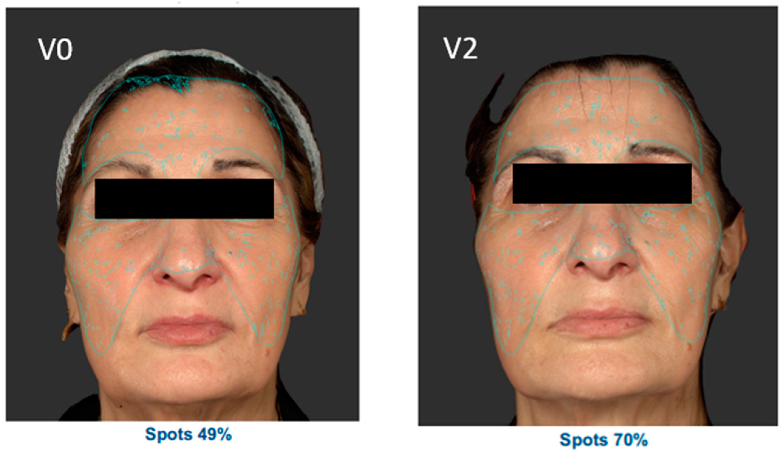 Cosmetics 10 00144 g006