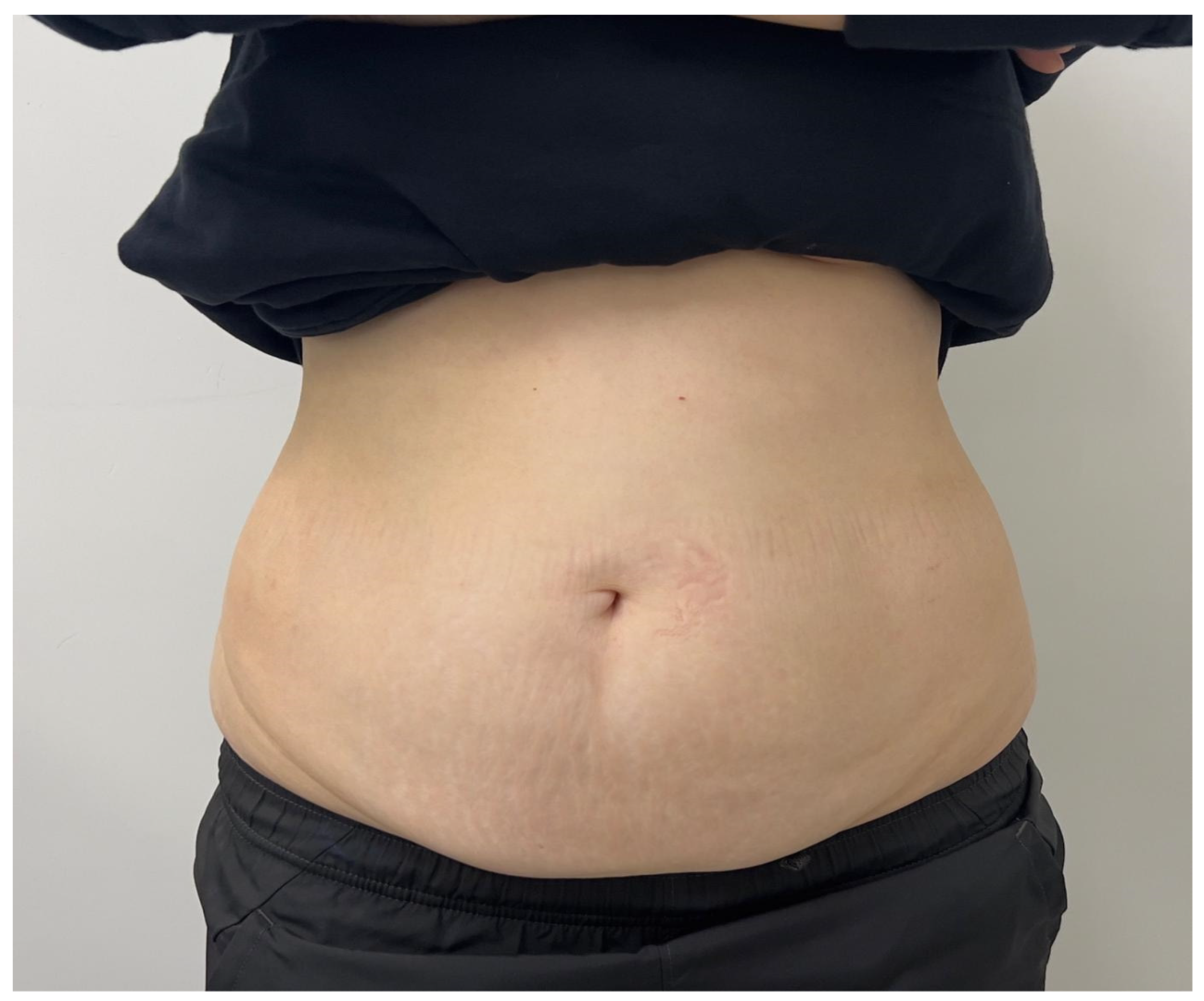 Cosmetics 10 00168 g001