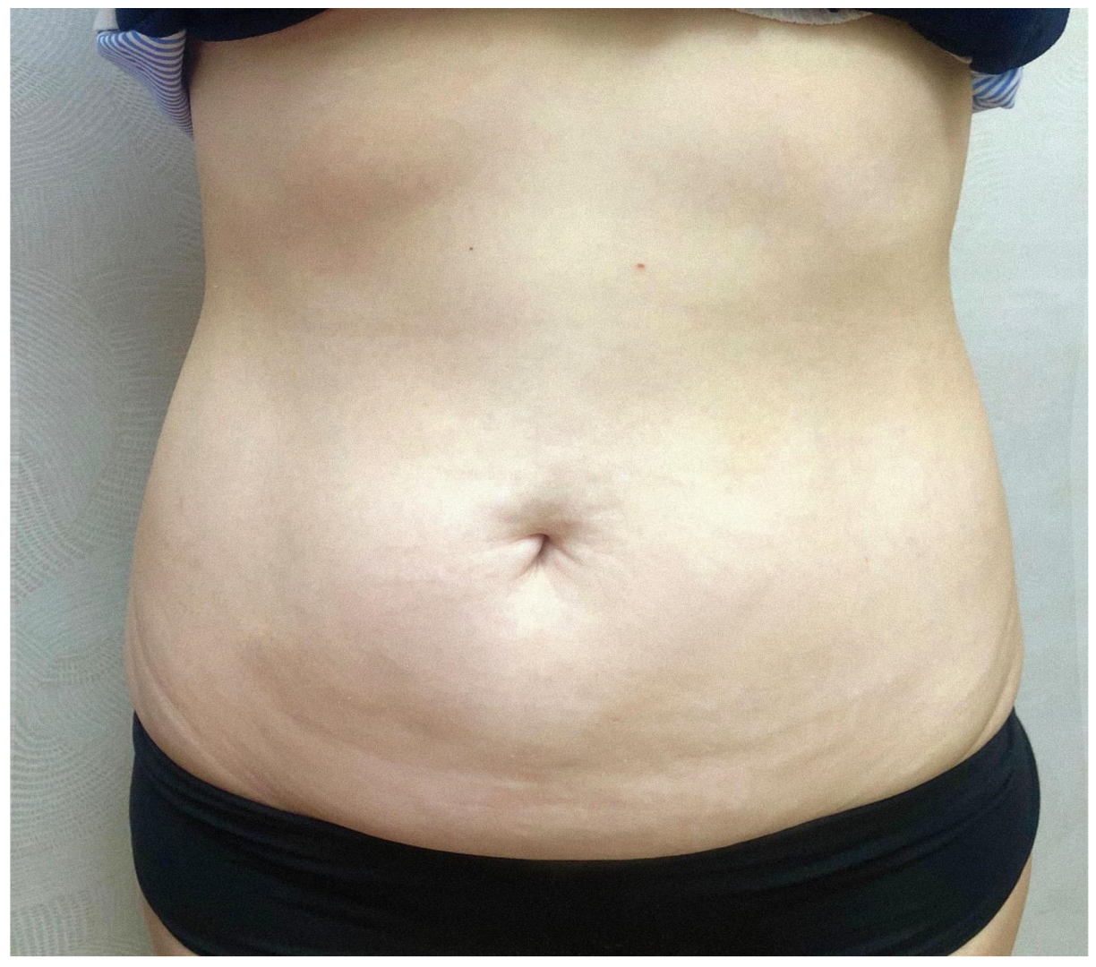 Cosmetics 10 00168 g002