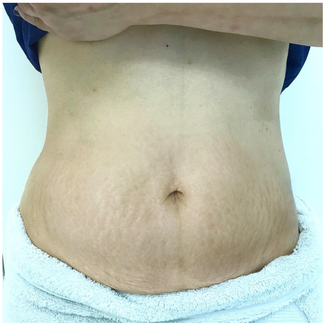 Cosmetics 10 00168 g005