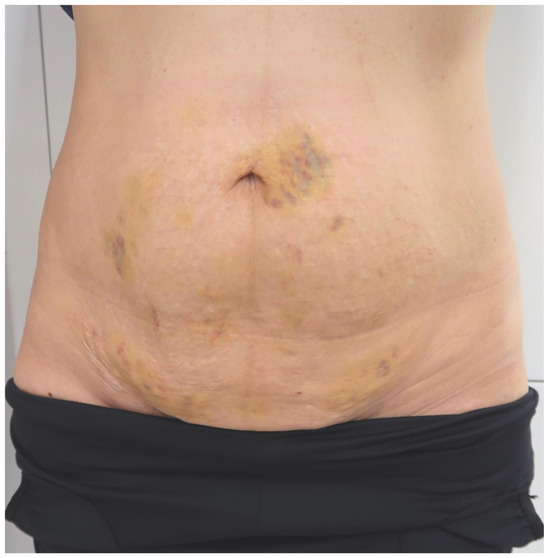 Cosmetics 10 00168 g006