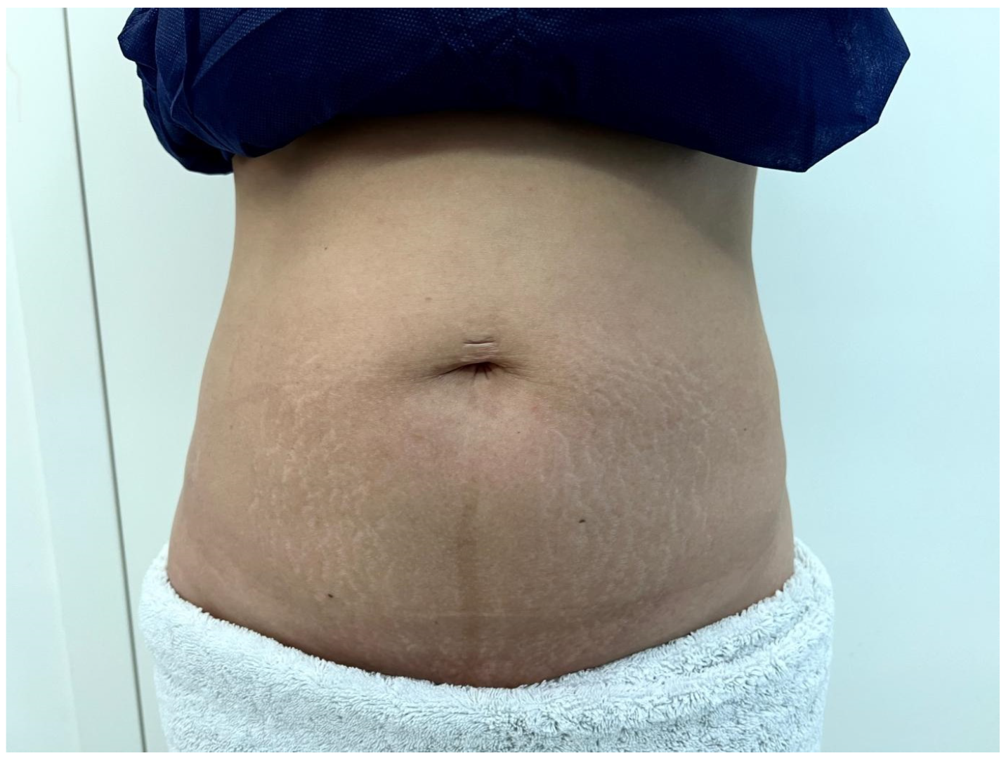 Cosmetics 10 00168 g008