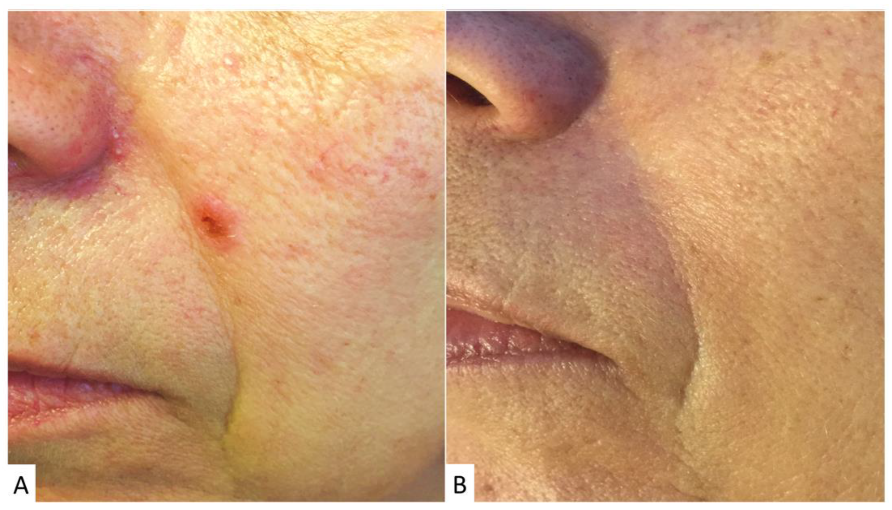 Cosmetics 11 00003 g004