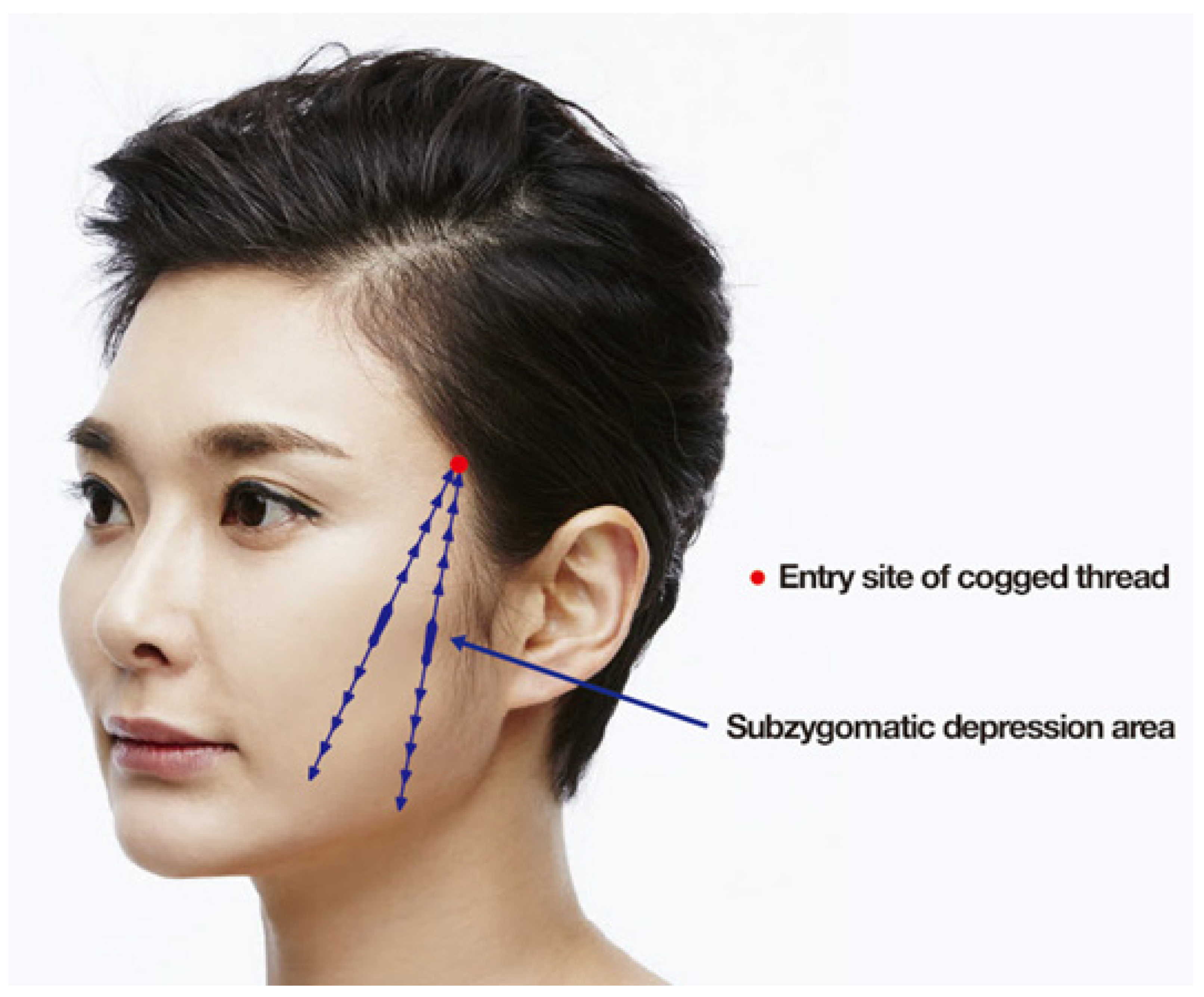 Cosmetics 11 00042 g013