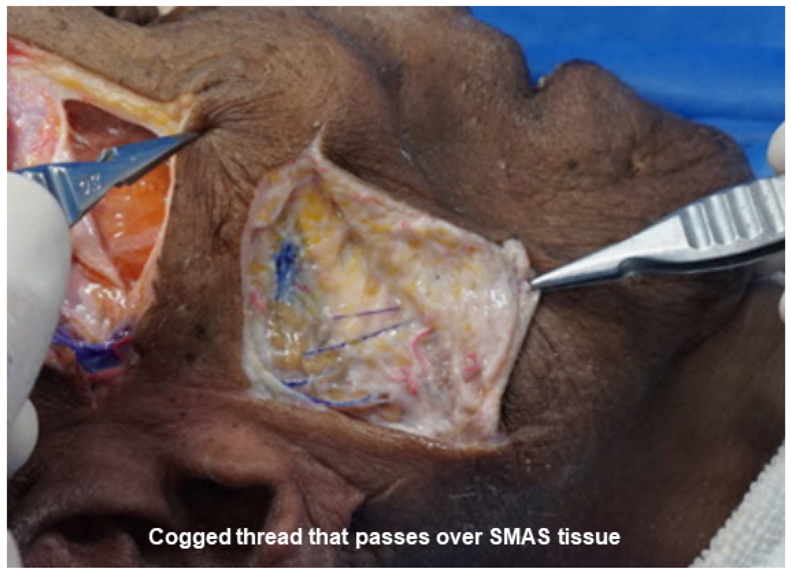 Cosmetics 11 00042 g016