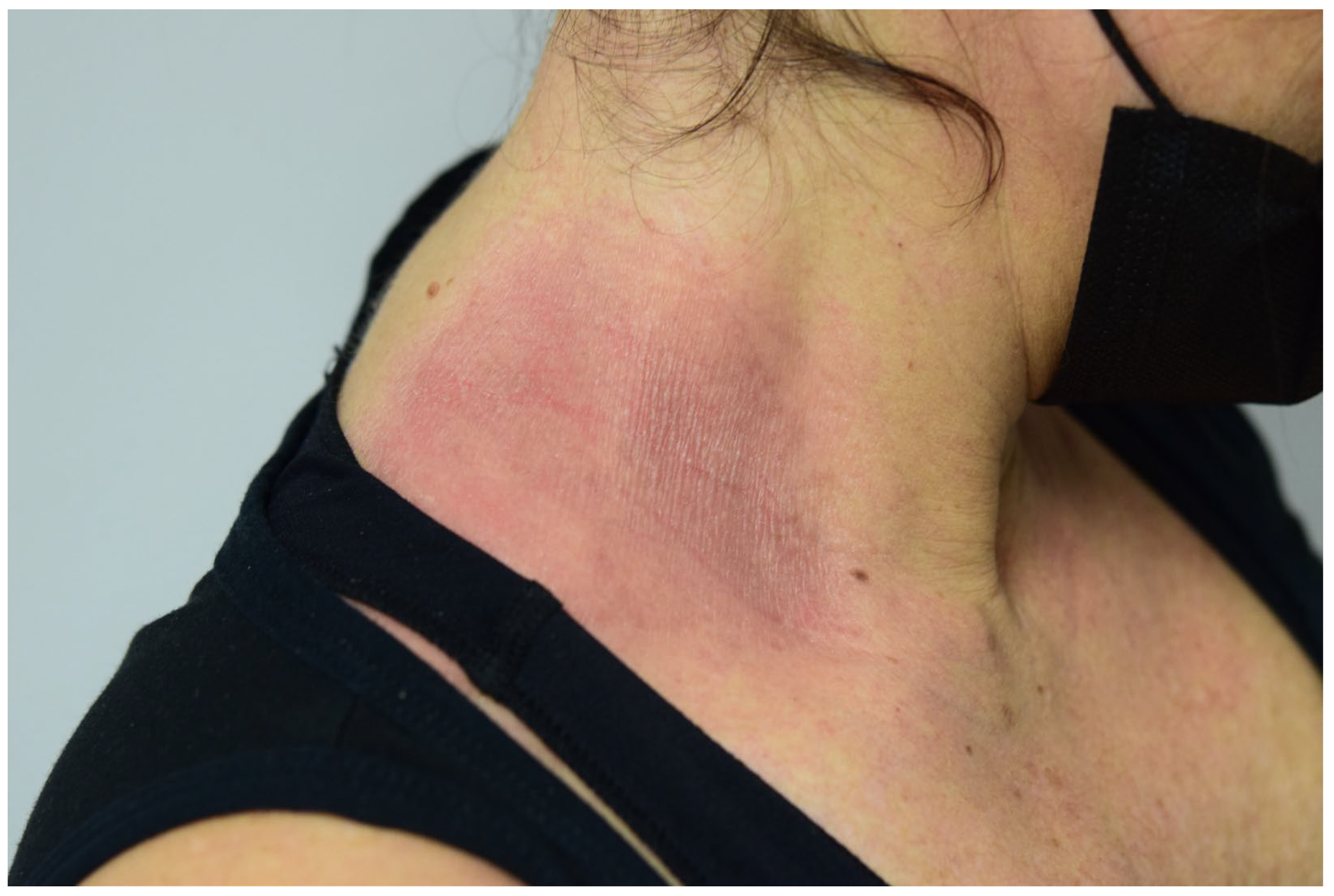 Cosmetics 11 00078 g001