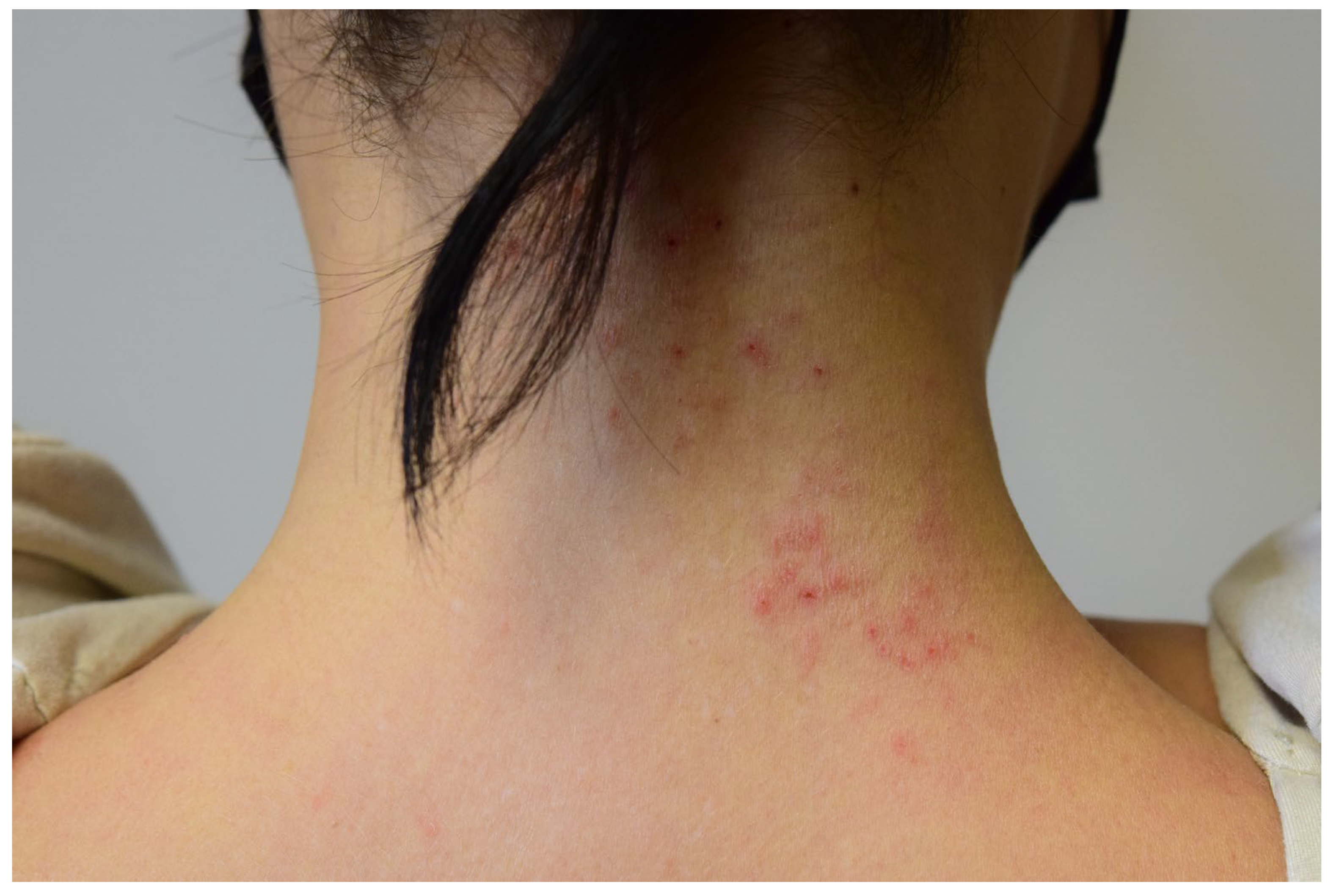 Cosmetics 11 00078 g003