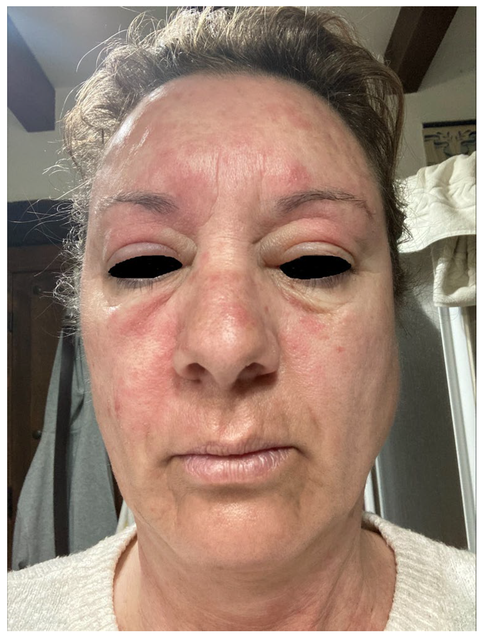 Cosmetics 11 00078 g004