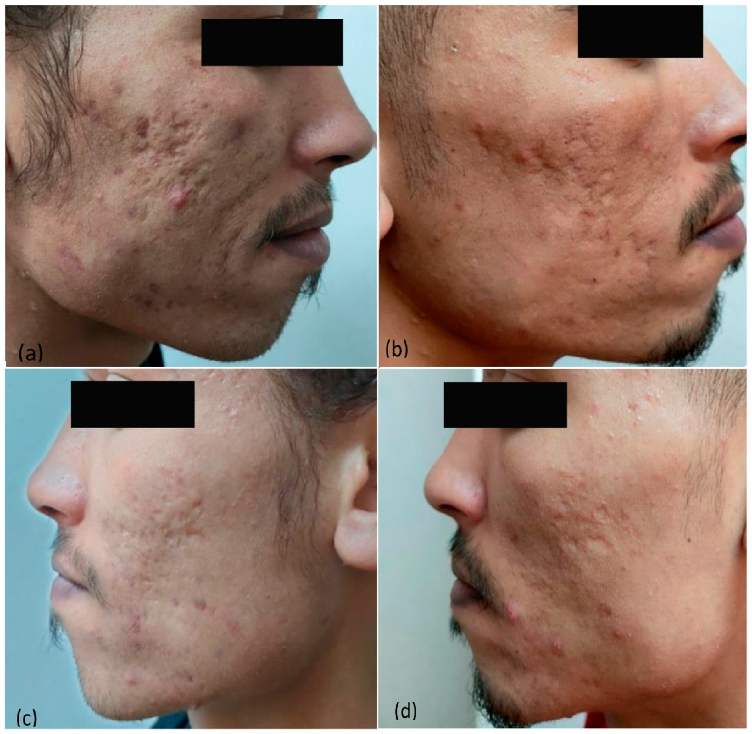 Cosmetics 11 00081 g001