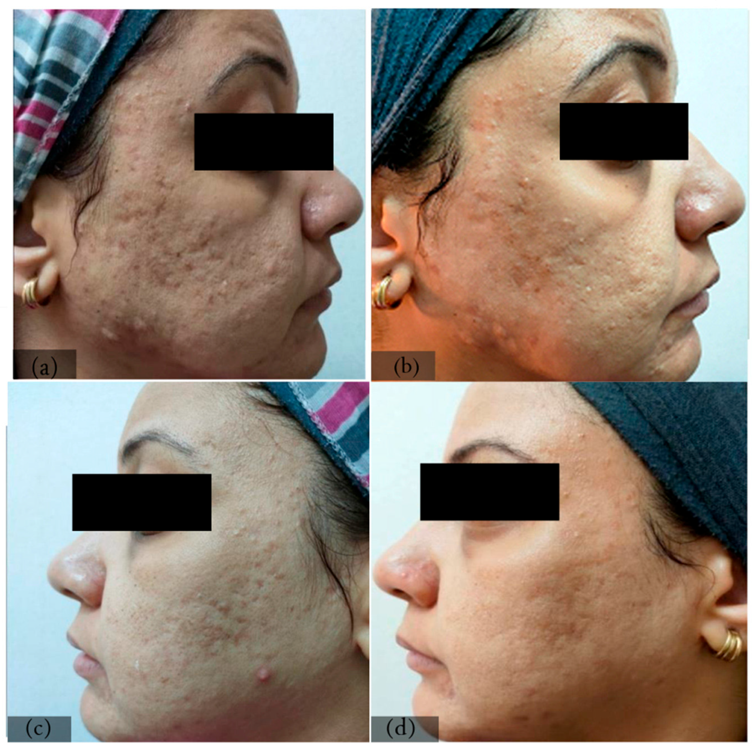 Cosmetics 11 00081 g002