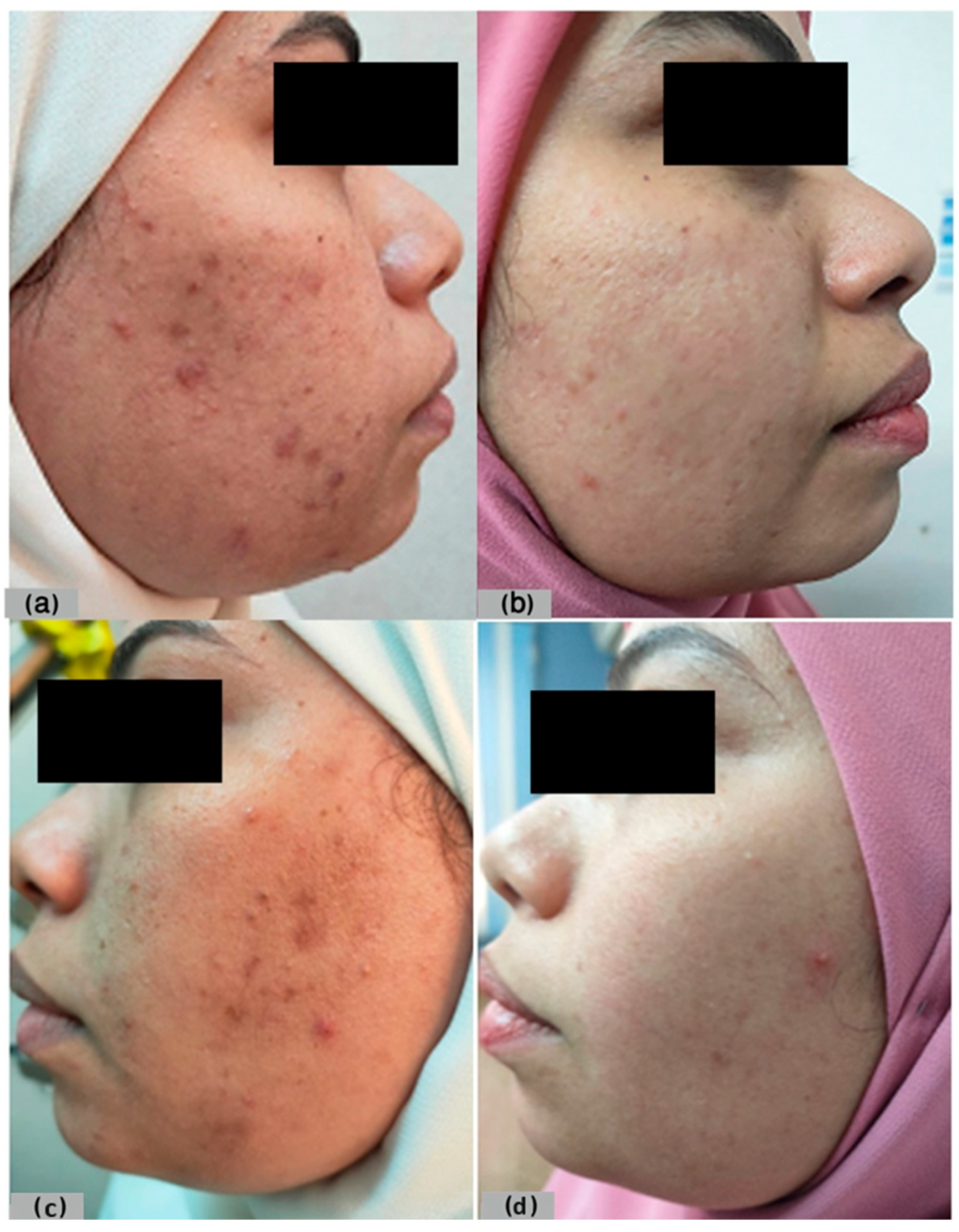 Cosmetics 11 00081 g003