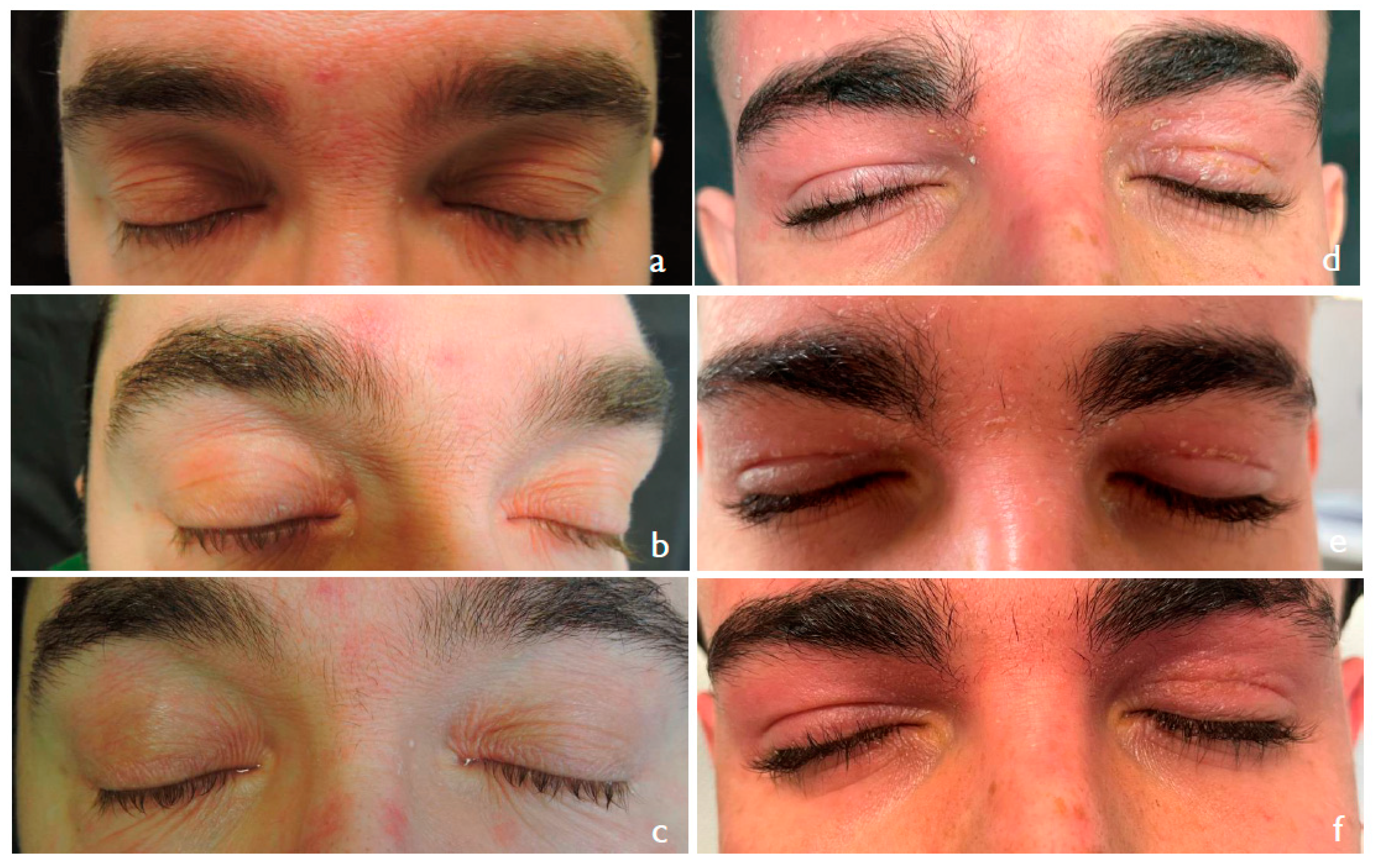 Cosmetics 11 00083 g002