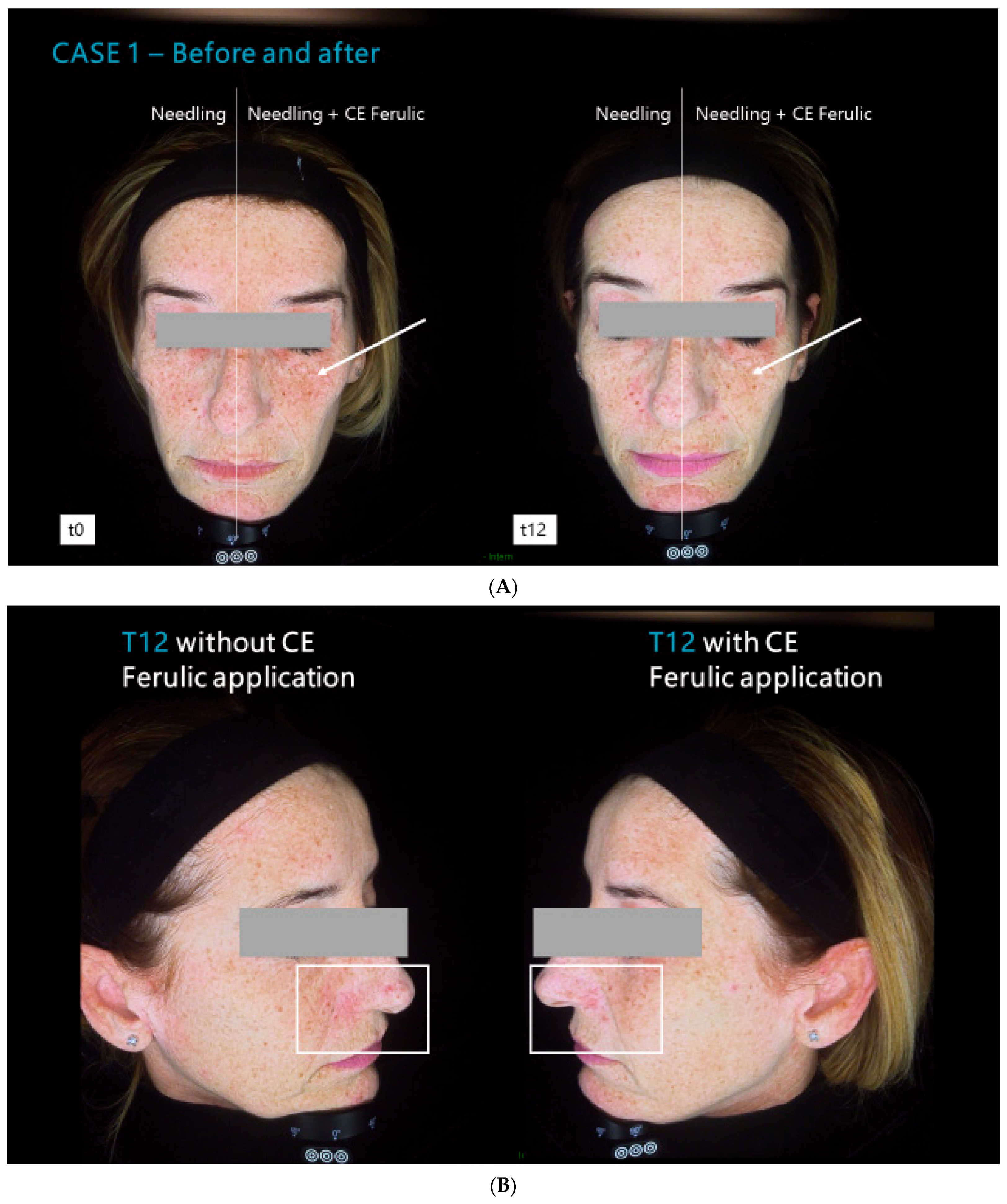 Cosmetics 11 00101 g002