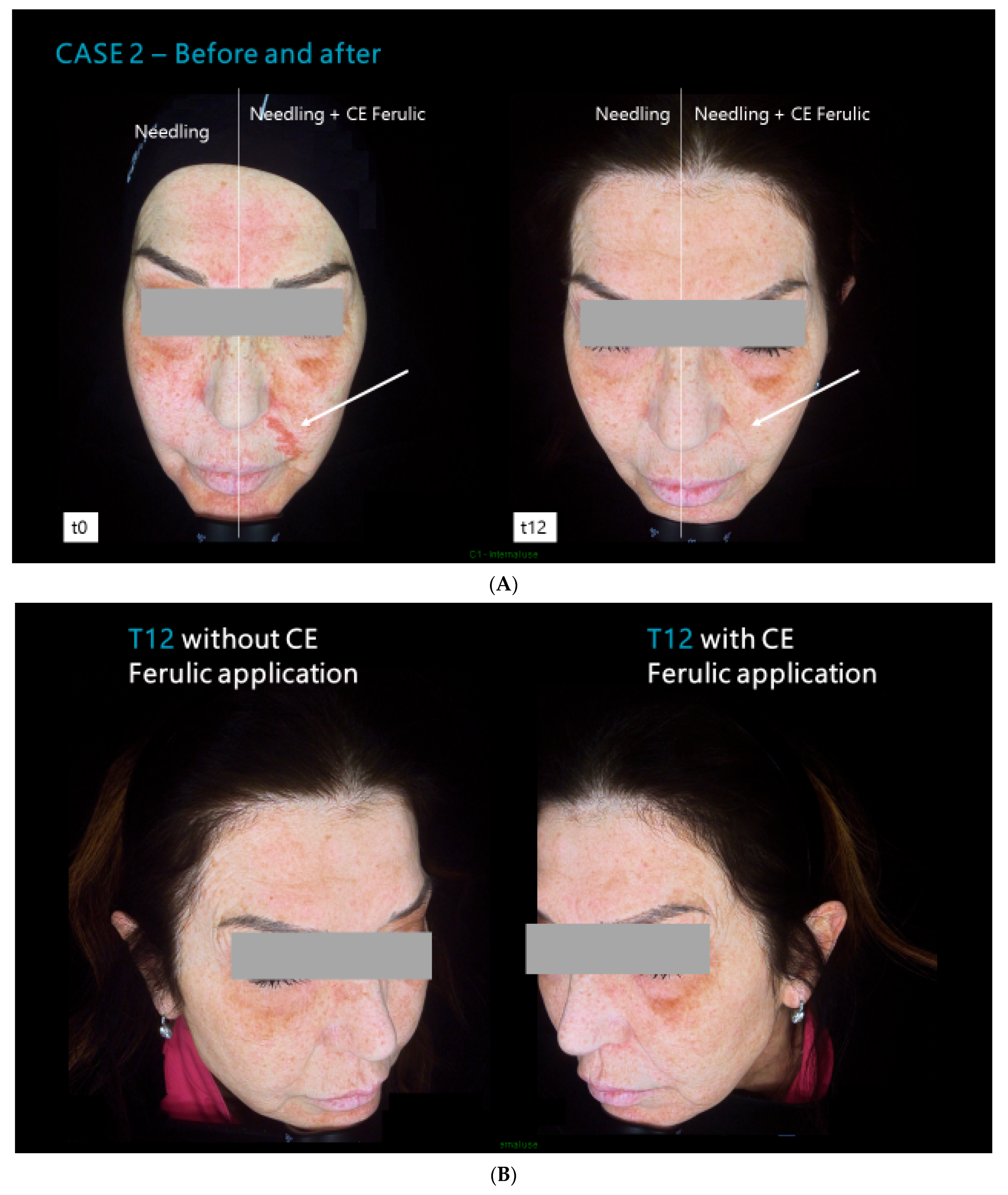 Cosmetics 11 00101 g003