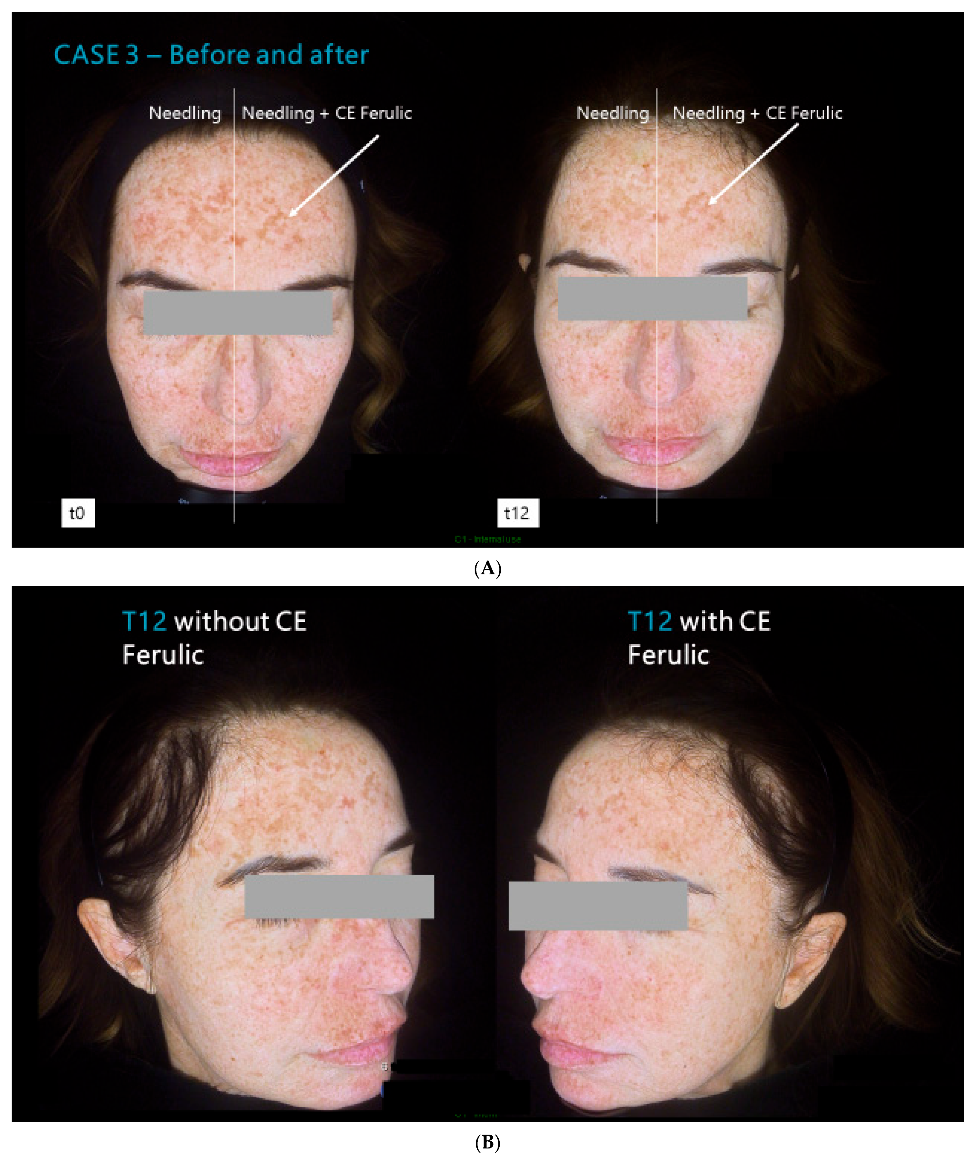 Cosmetics 11 00101 g004