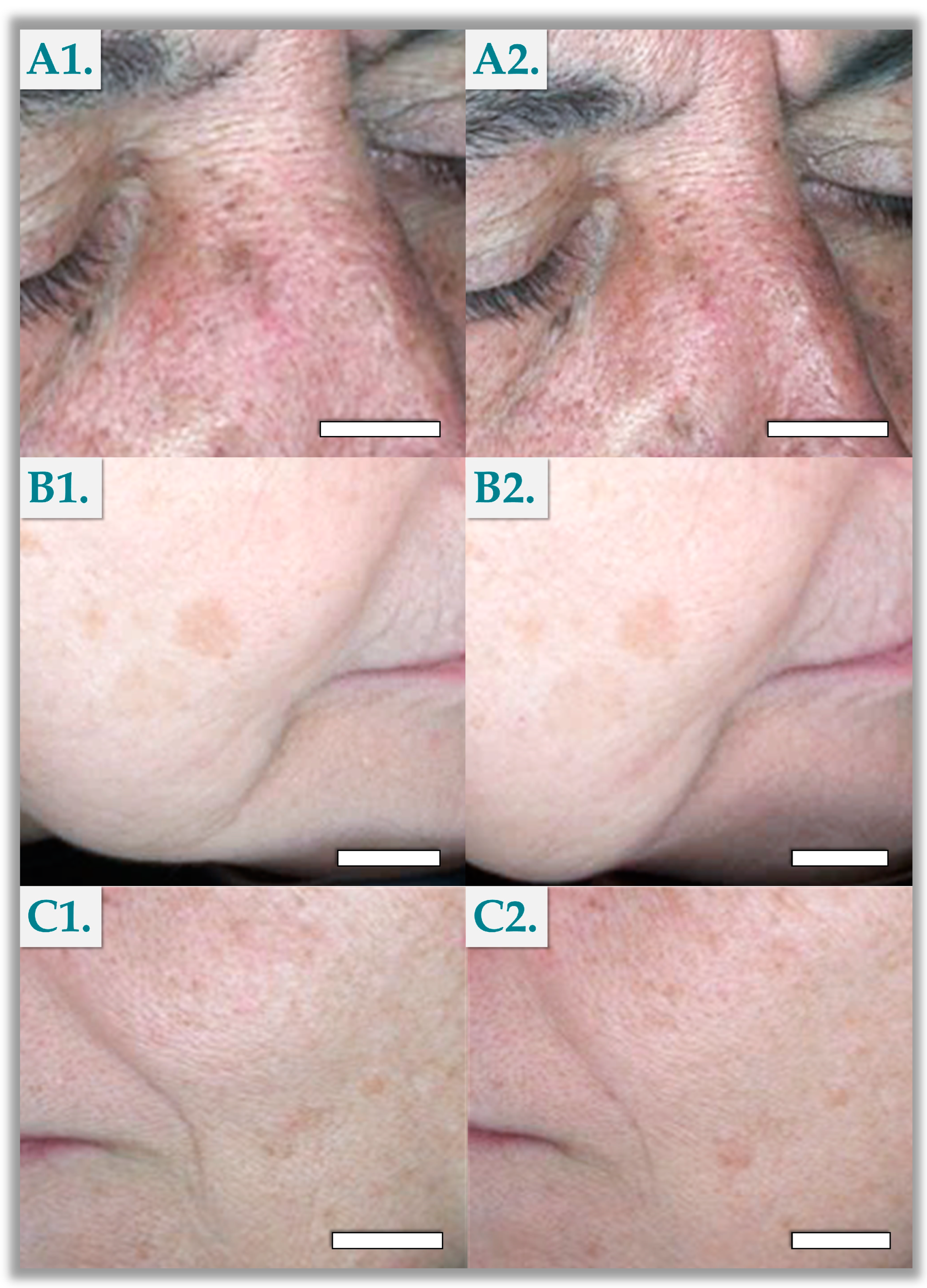 Cosmetics 11 00168 g001