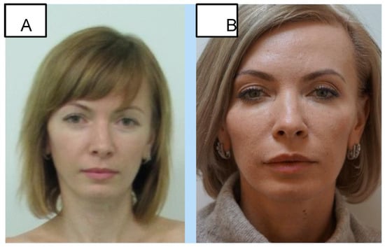 Cosmetics 11 00192 g007