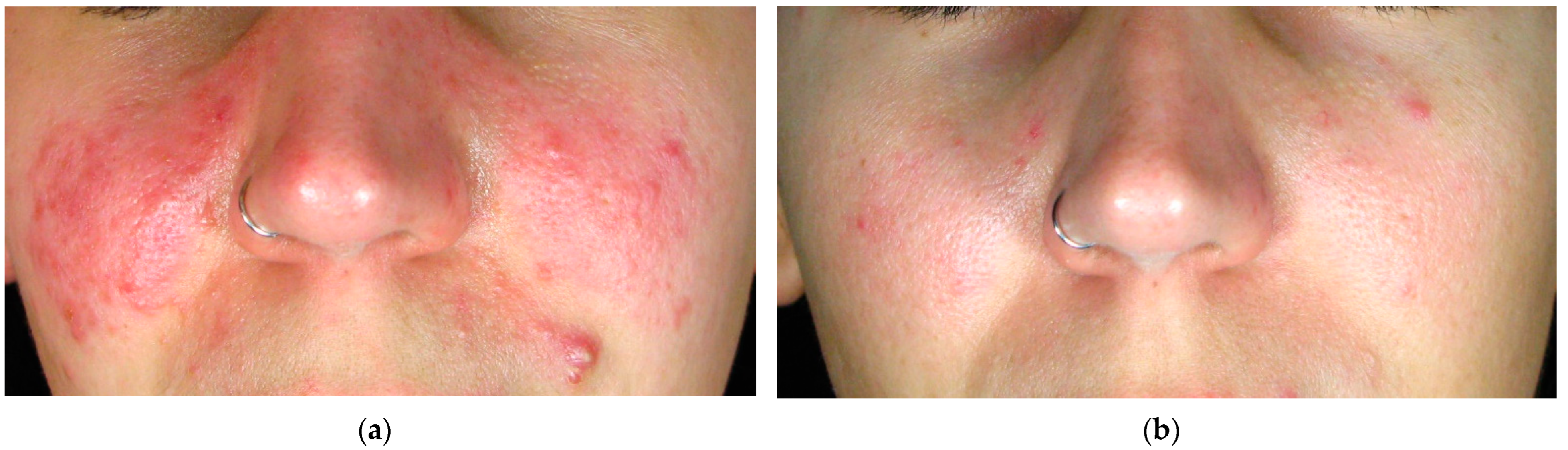 Cosmetics 11 00227 g001 Cosmetics 11 00227 g001