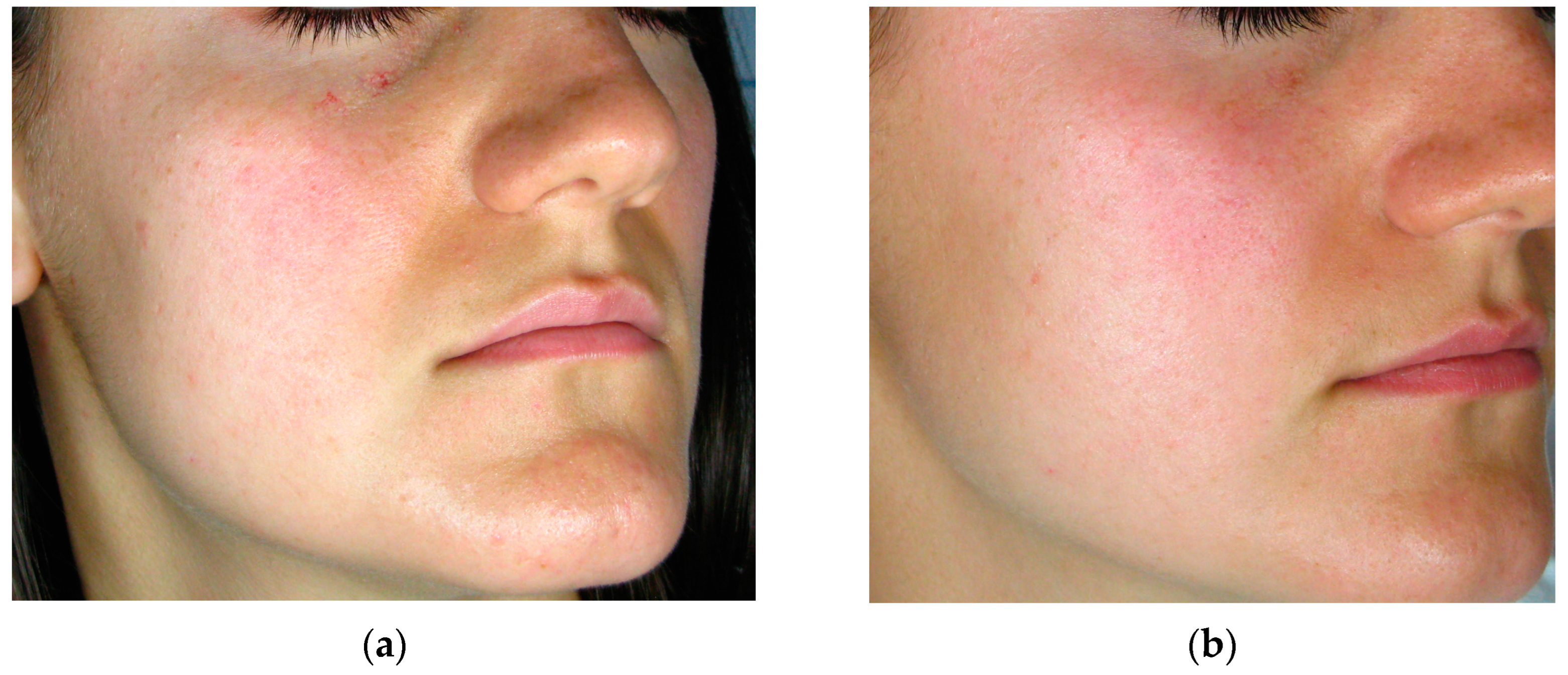 Cosmetics 11 00227 g007 Cosmetics 11 00227 g007