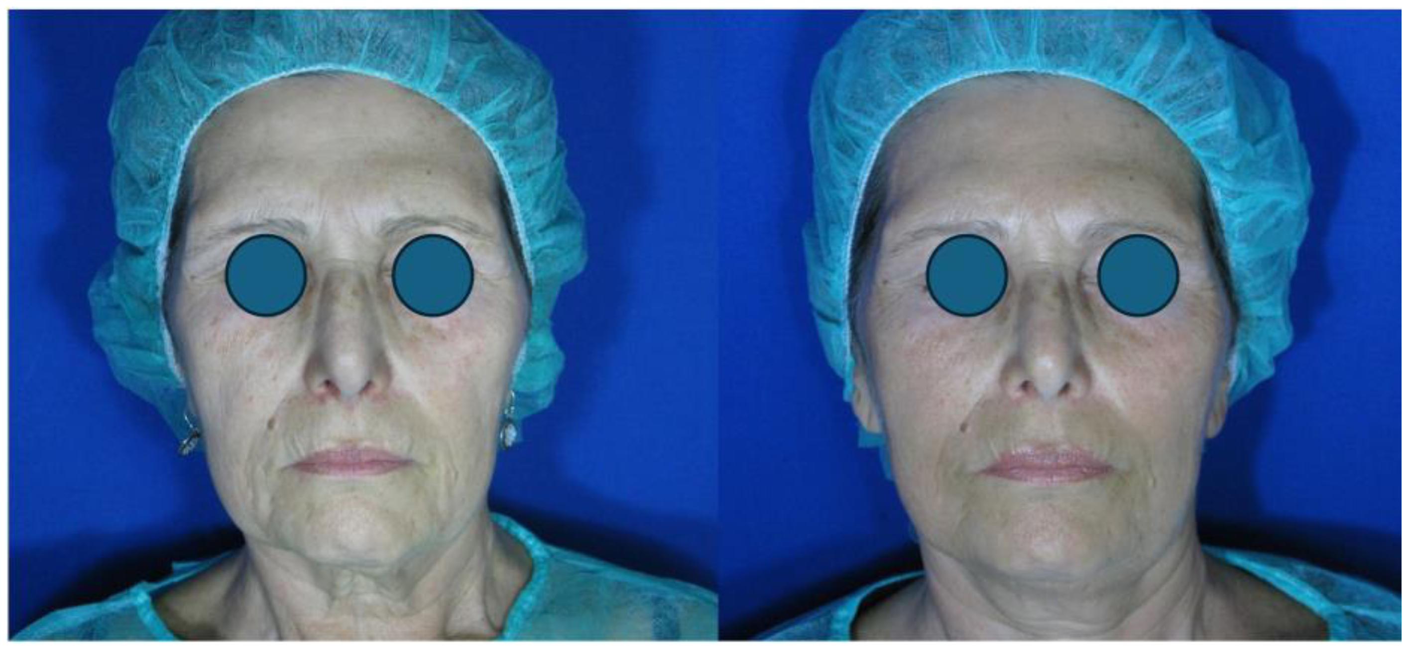 Cosmetics 12 00030 g003