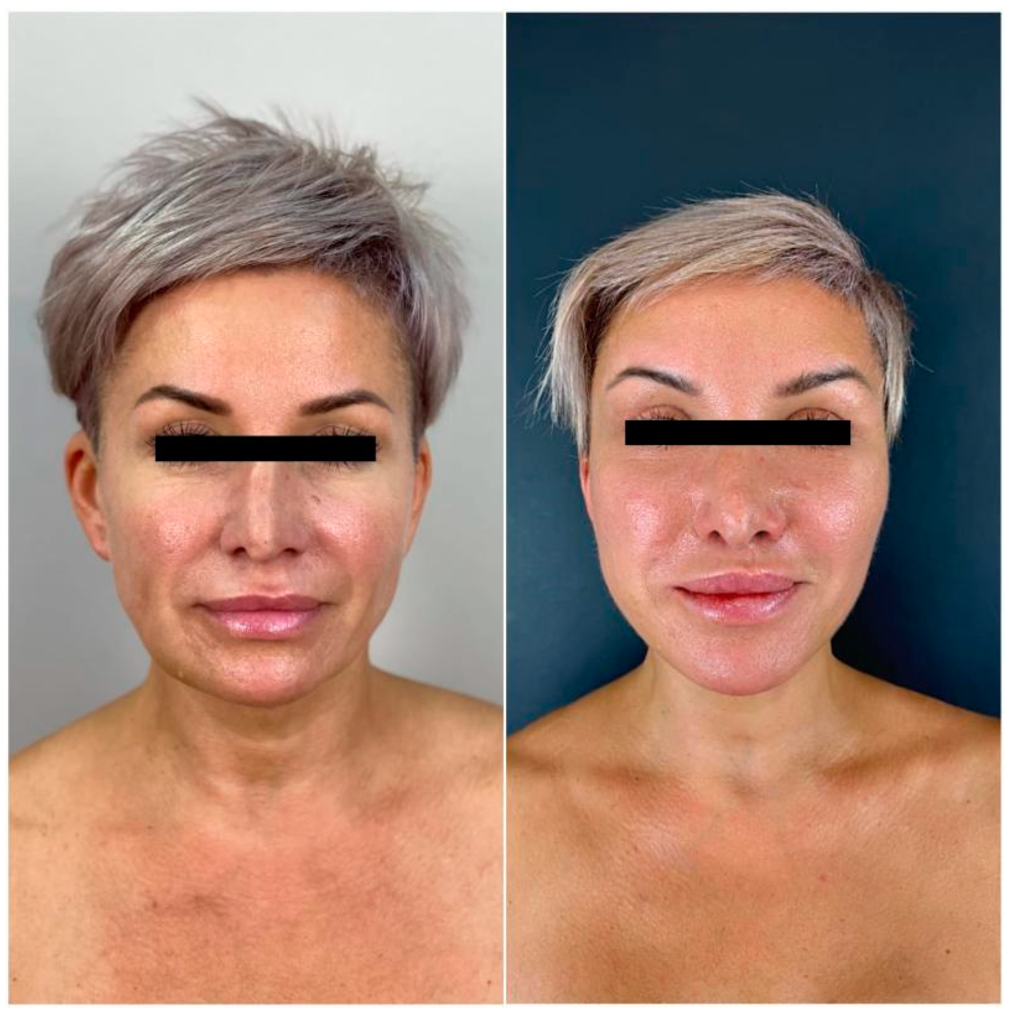 Cosmetics 12 00039 g012