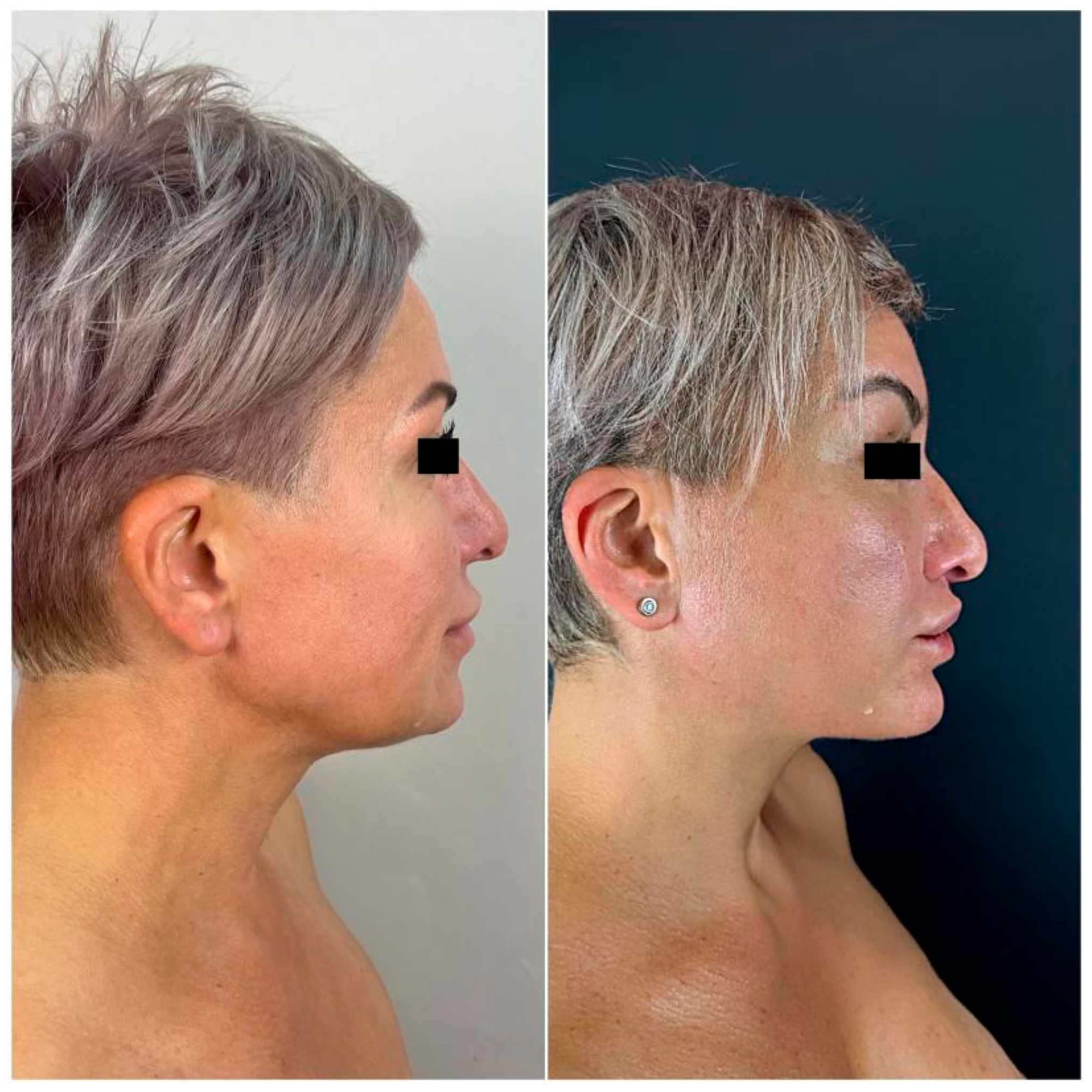 Cosmetics 12 00039 g013