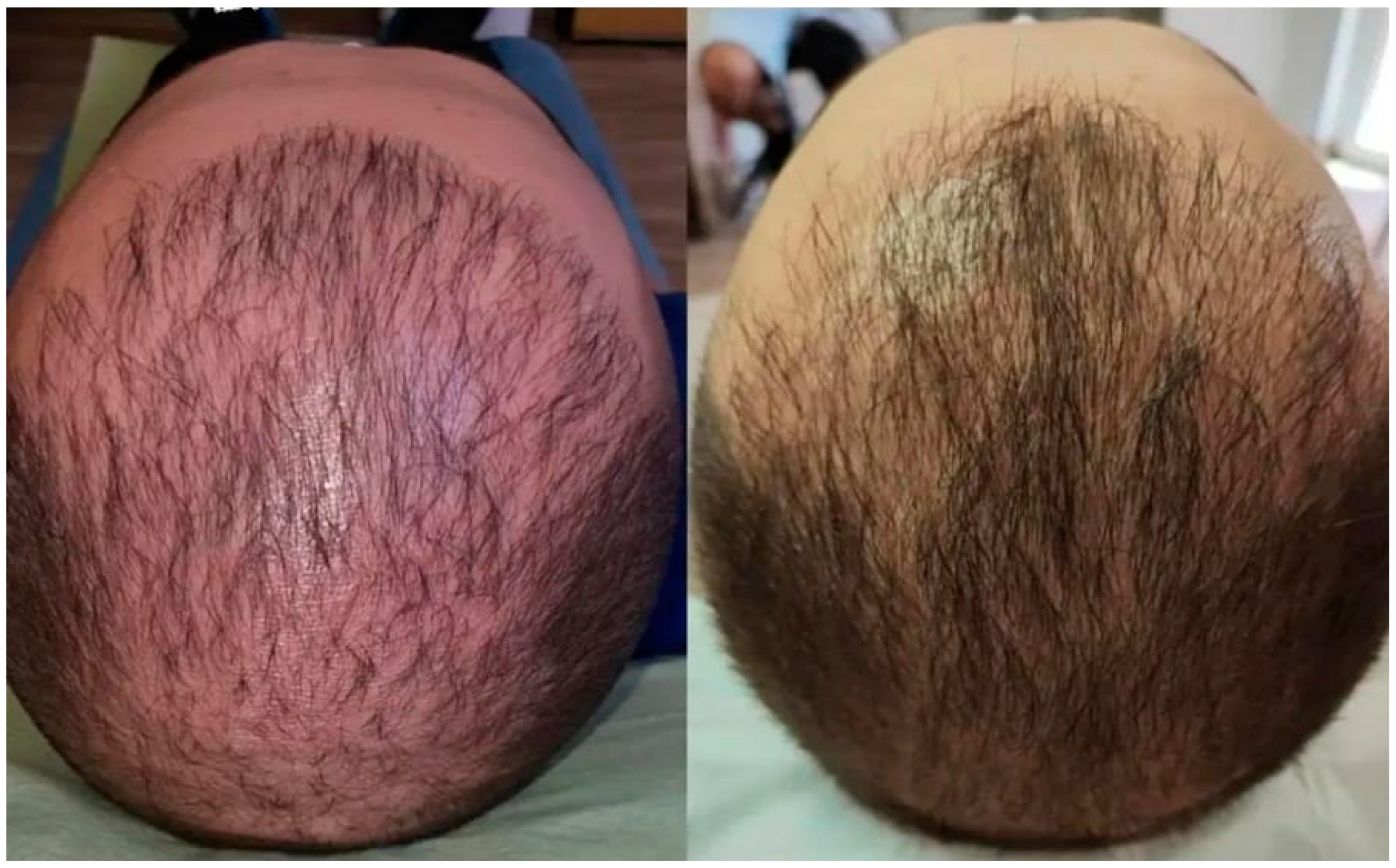 Cosmetics 12 00046 g011