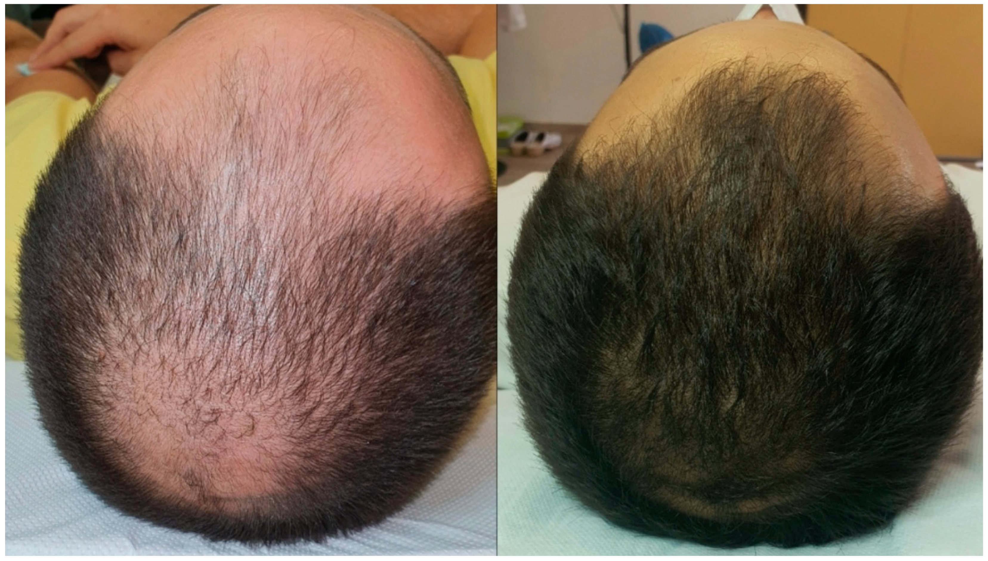 Cosmetics 12 00046 g012