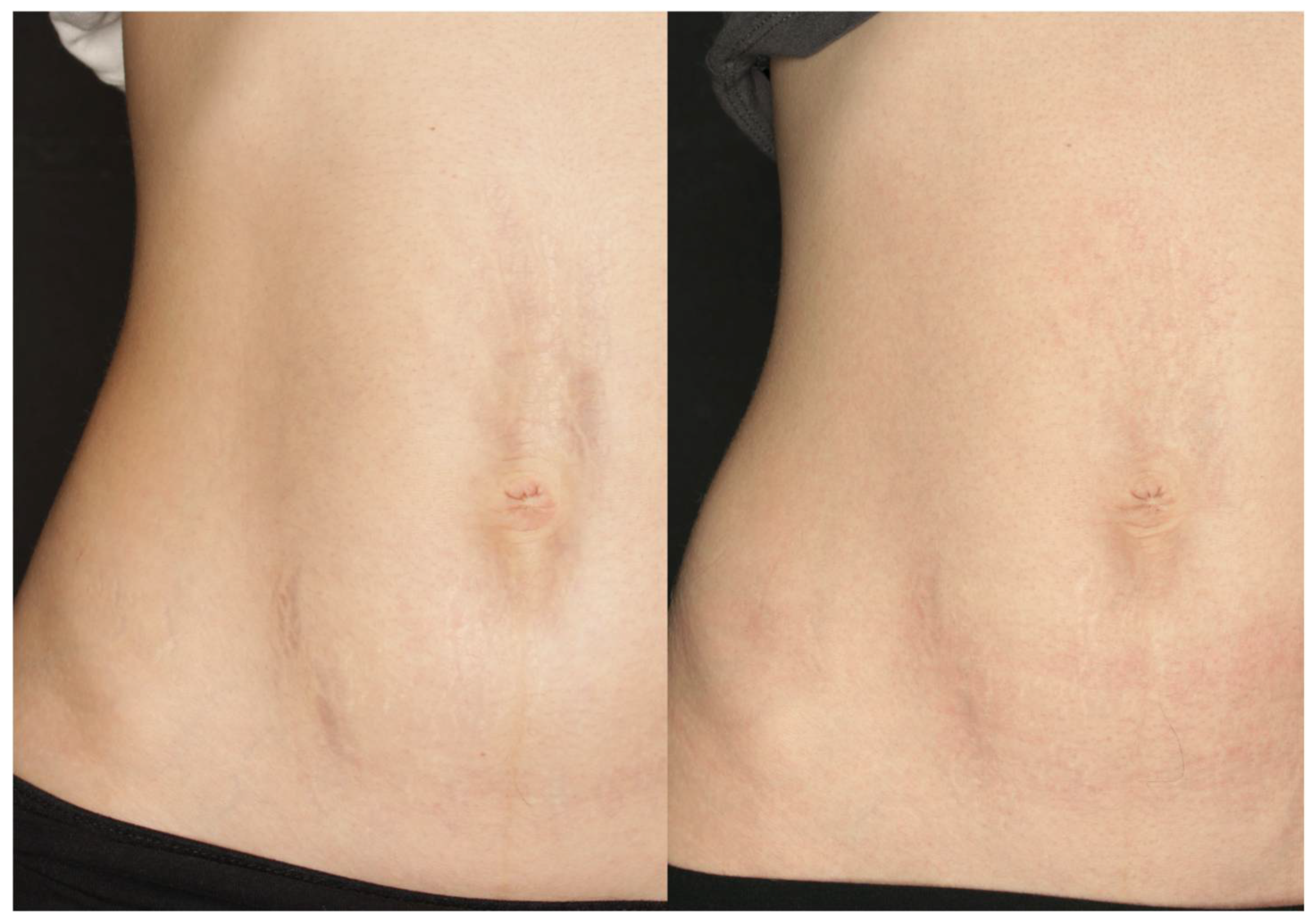 Cosmetics 12 00148 g007