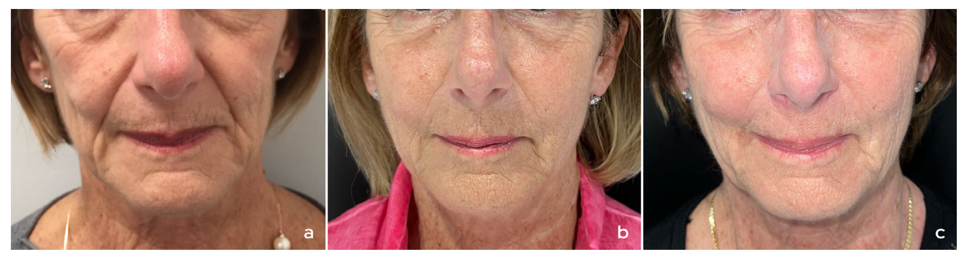 Cosmetics 12 00264 g001