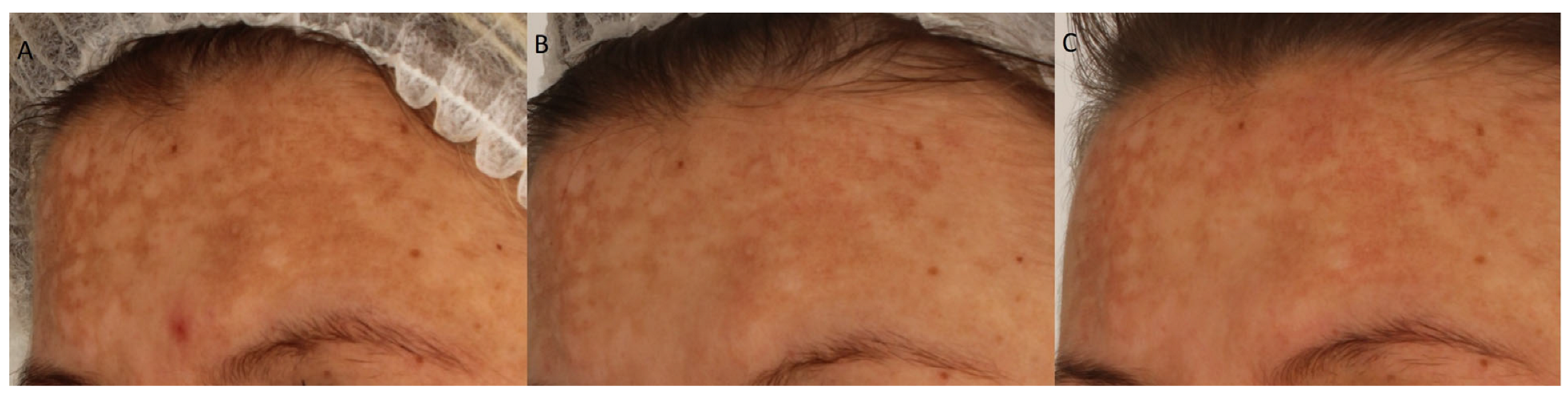 Cosmetics 12 00276 g002 Cosmetics 12 00276 g002