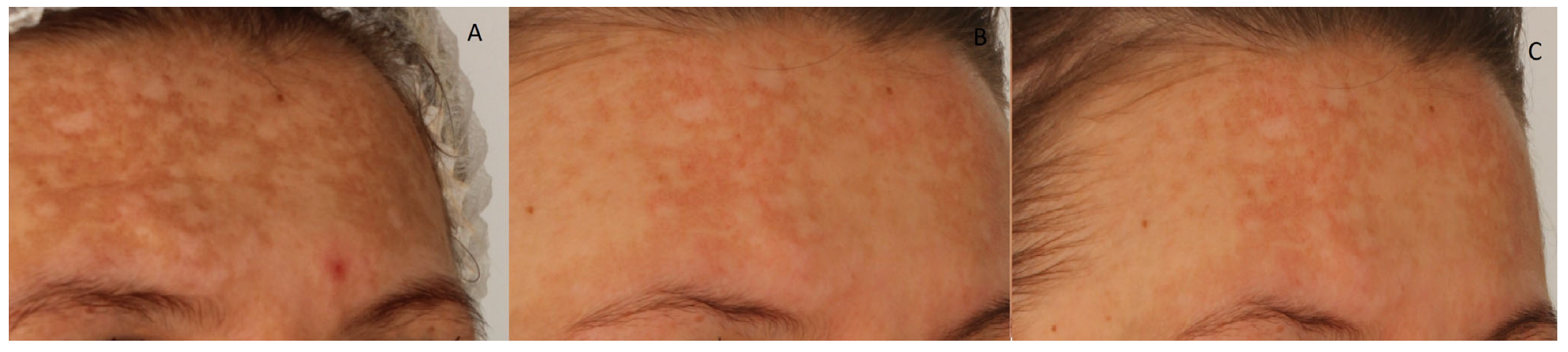Cosmetics 12 00276 g003 Cosmetics 12 00276 g003