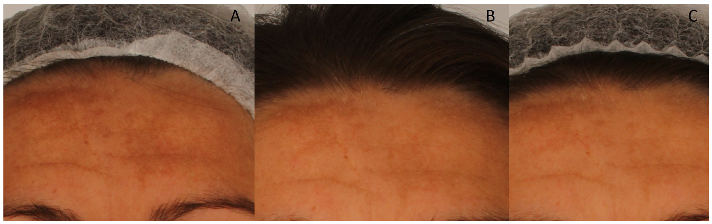Cosmetics 12 00276 g004 Cosmetics 12 00276 g004