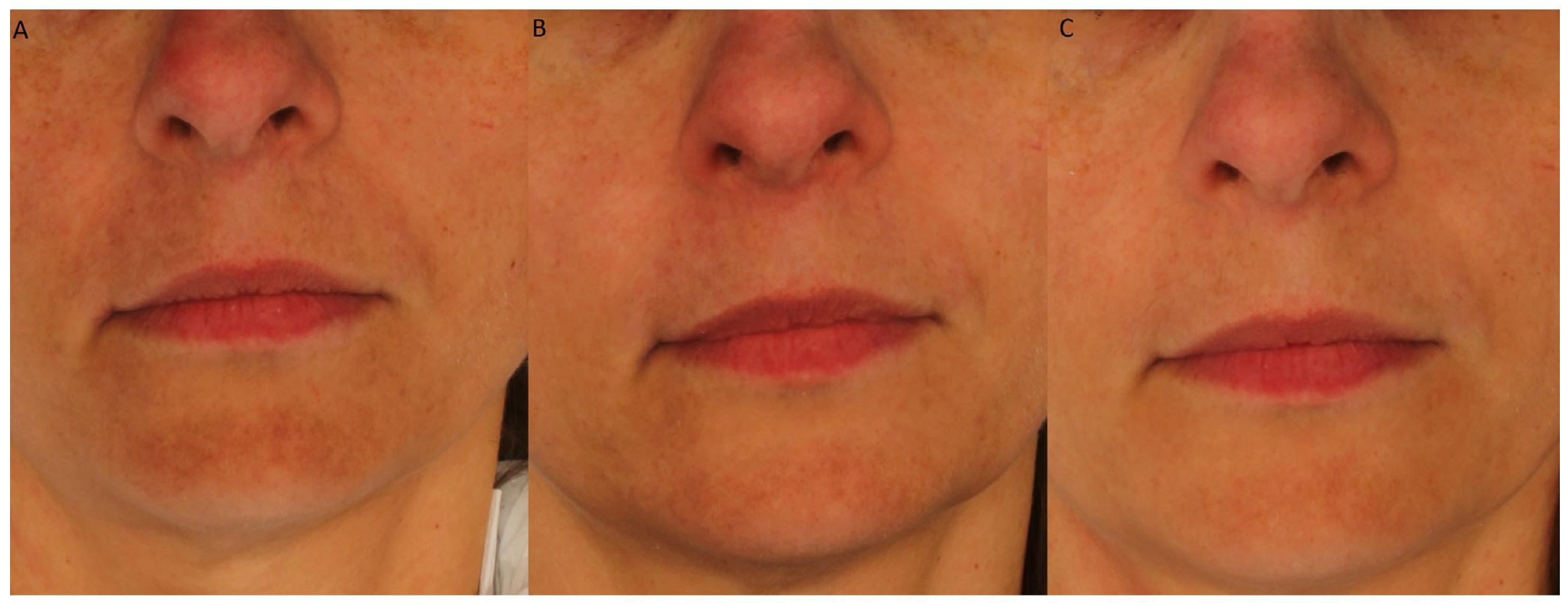 Cosmetics 12 00276 g005 Cosmetics 12 00276 g005