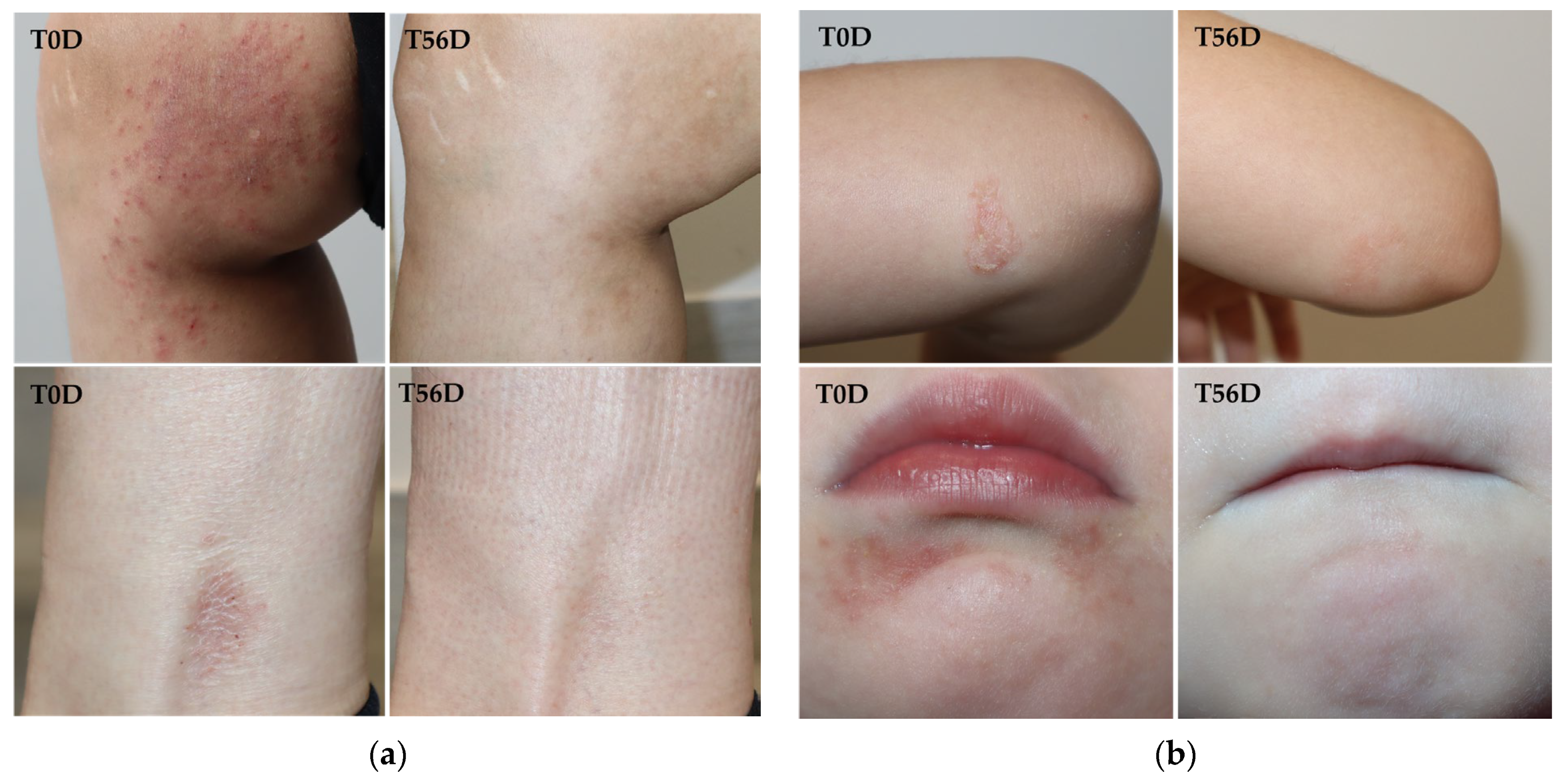 Cosmetics 13 00020 g005