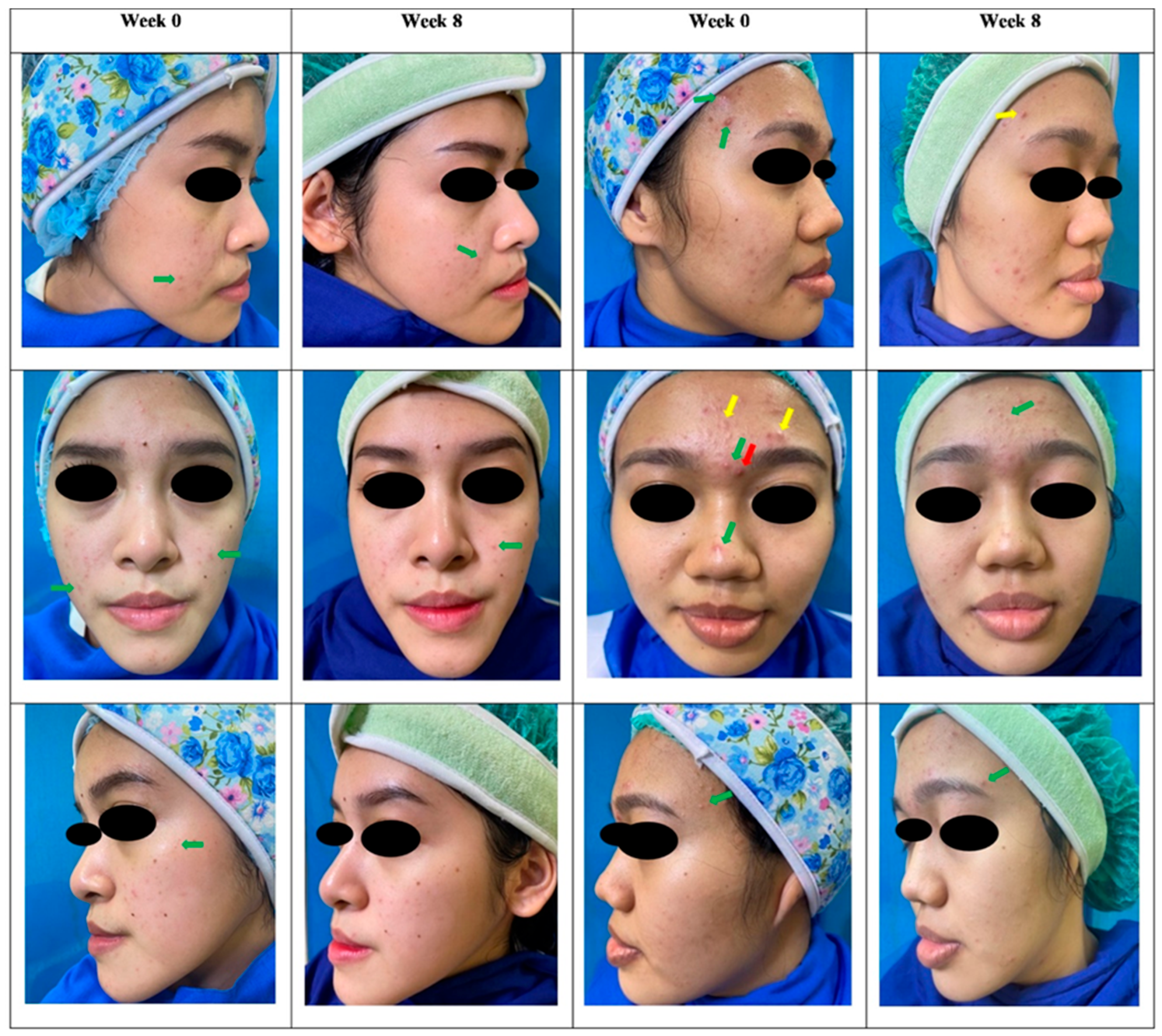 Cosmetics 13 00215 g002 Cosmetics 13 00215 g002