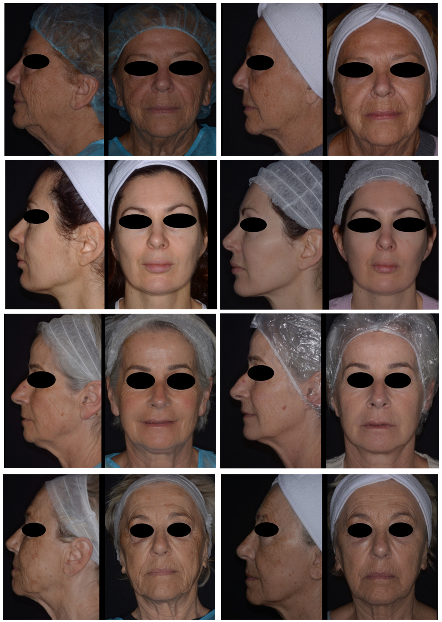 Cosmetics 13 00221 g003 Cosmetics 13 00221 g003
