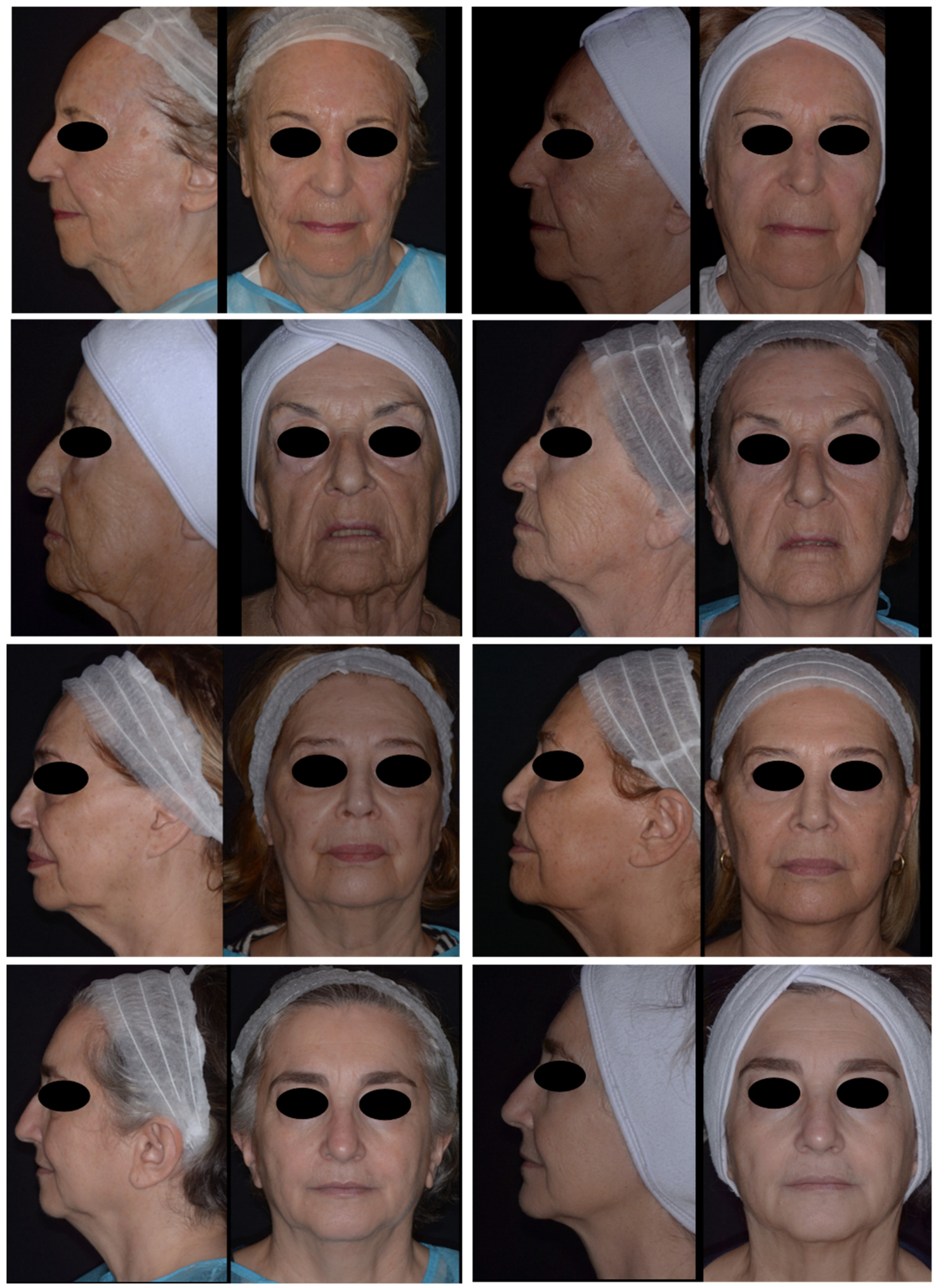 Cosmetics 13 00221 g004 Cosmetics 13 00221 g004