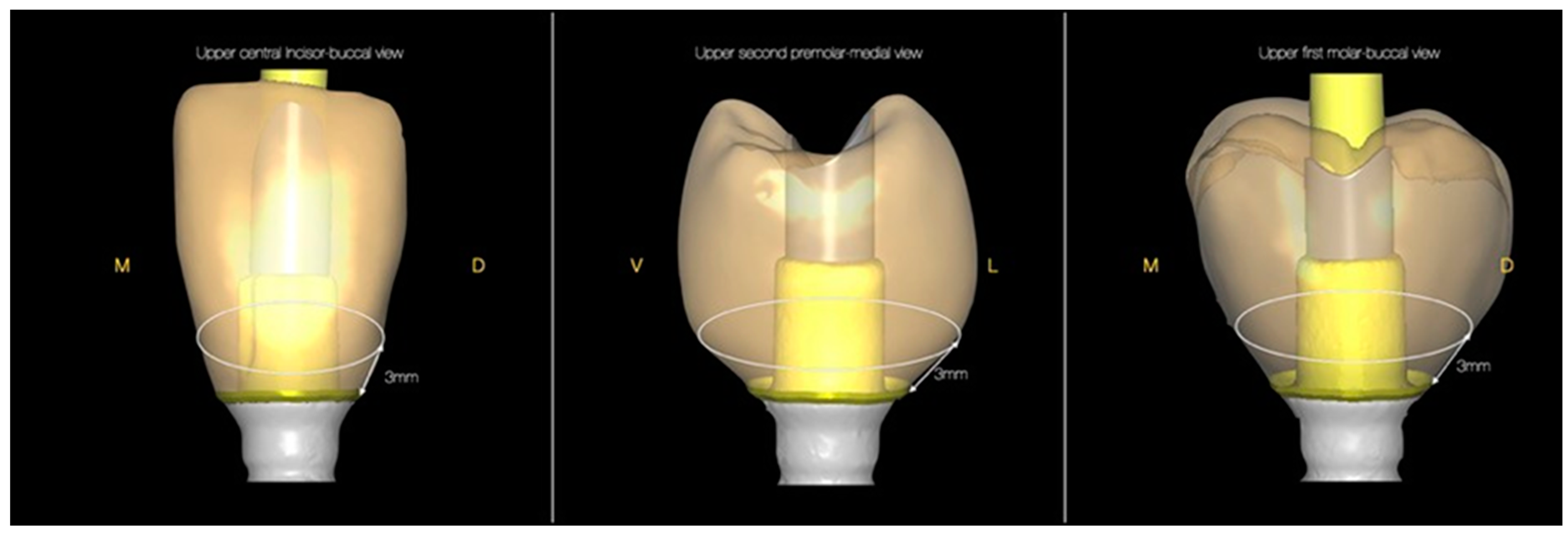 Crystals 12 00465 g005