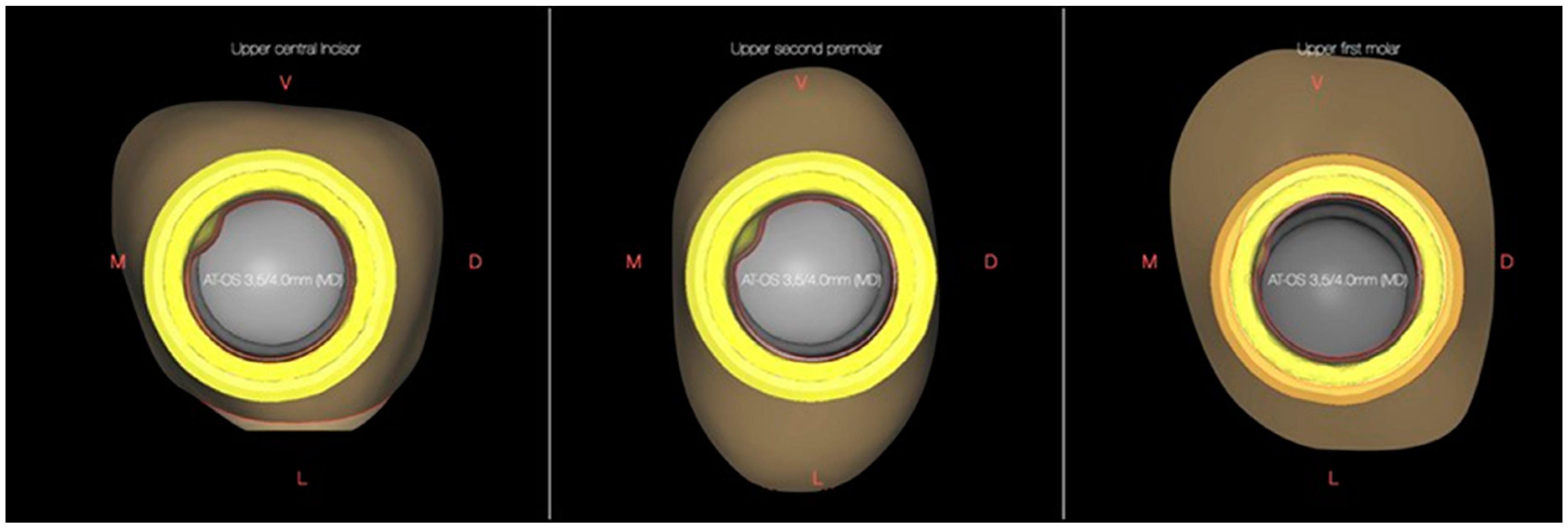 Crystals 12 00465 g006