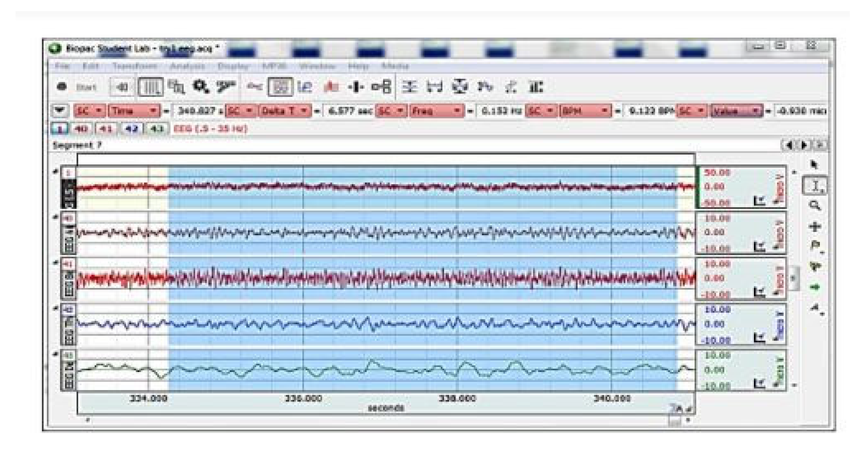 Crystals 12 01526 g007