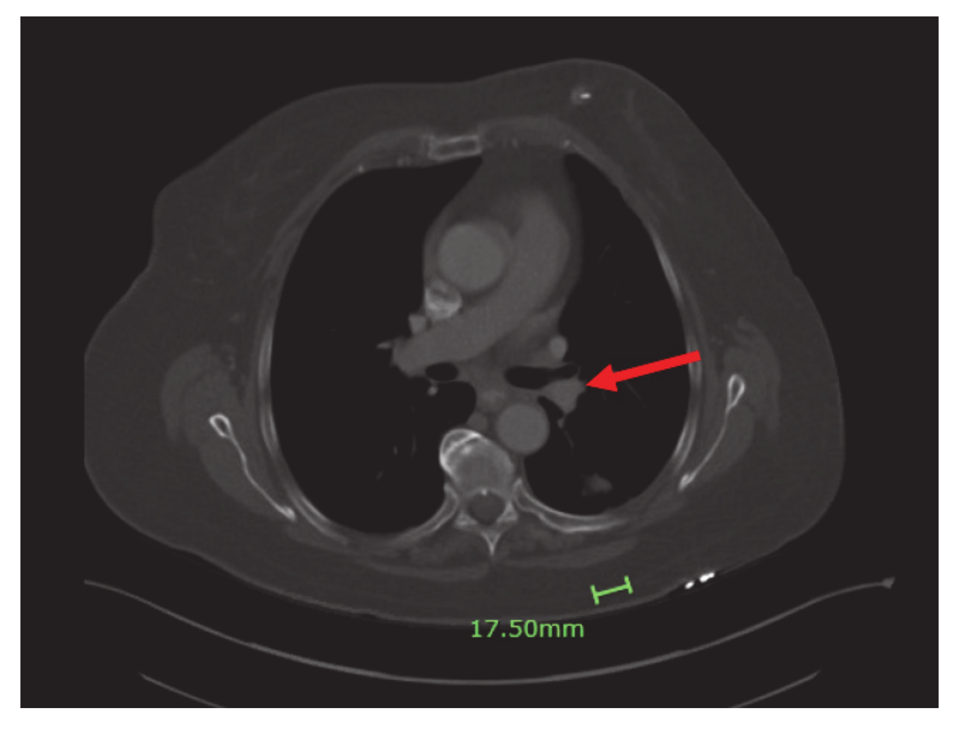 Curroncol 28 00021 g004