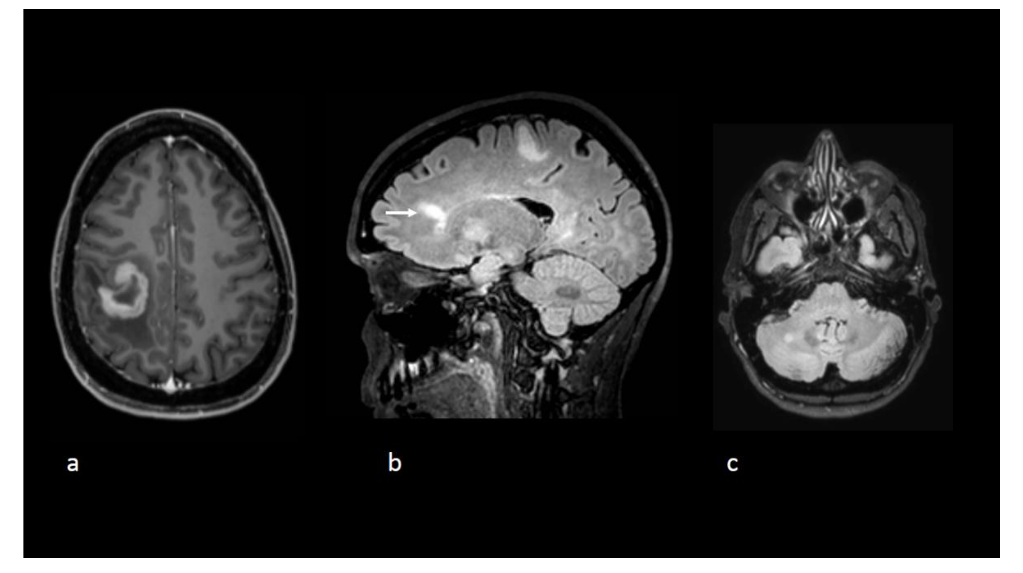 Curroncol 28 00022 g001 Curroncol 28 00022 g001