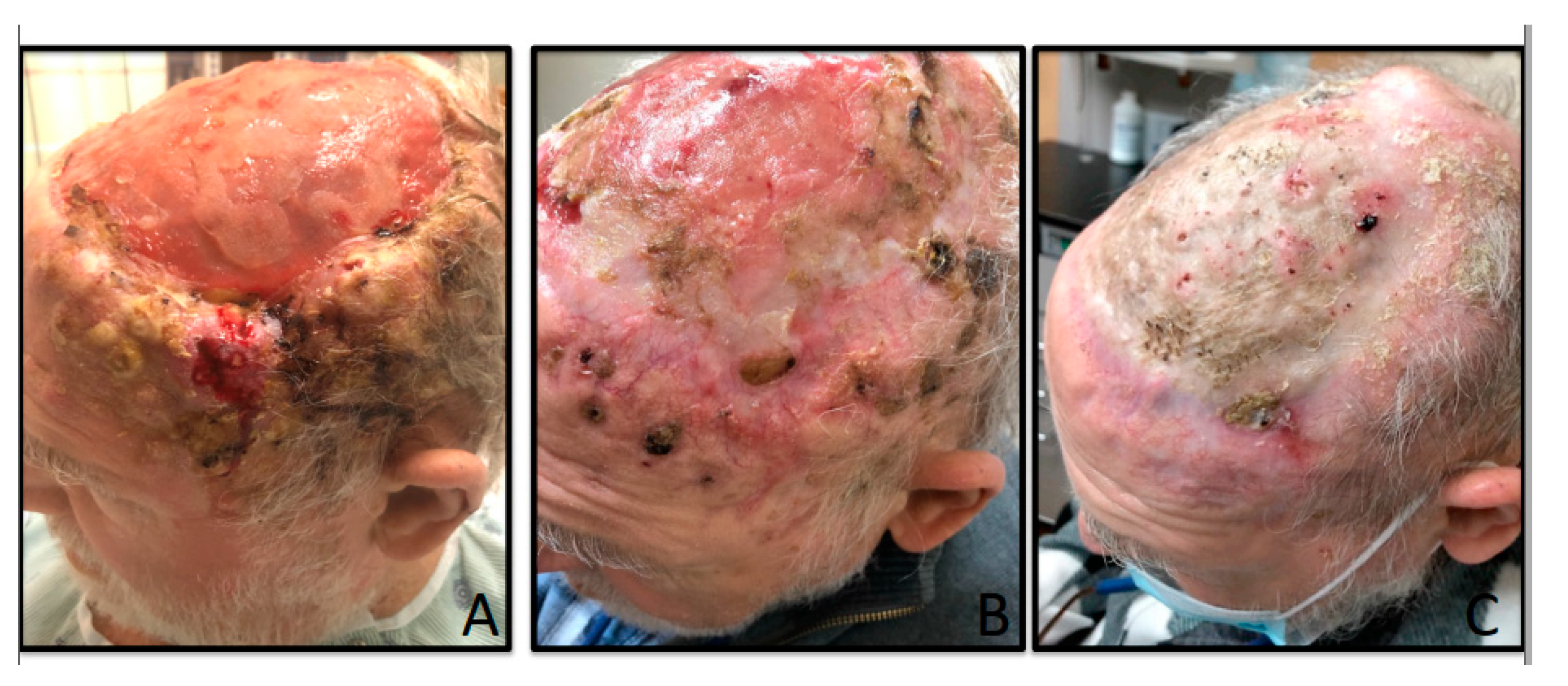 Curroncol 28 00057 g002 Curroncol 28 00057 g002