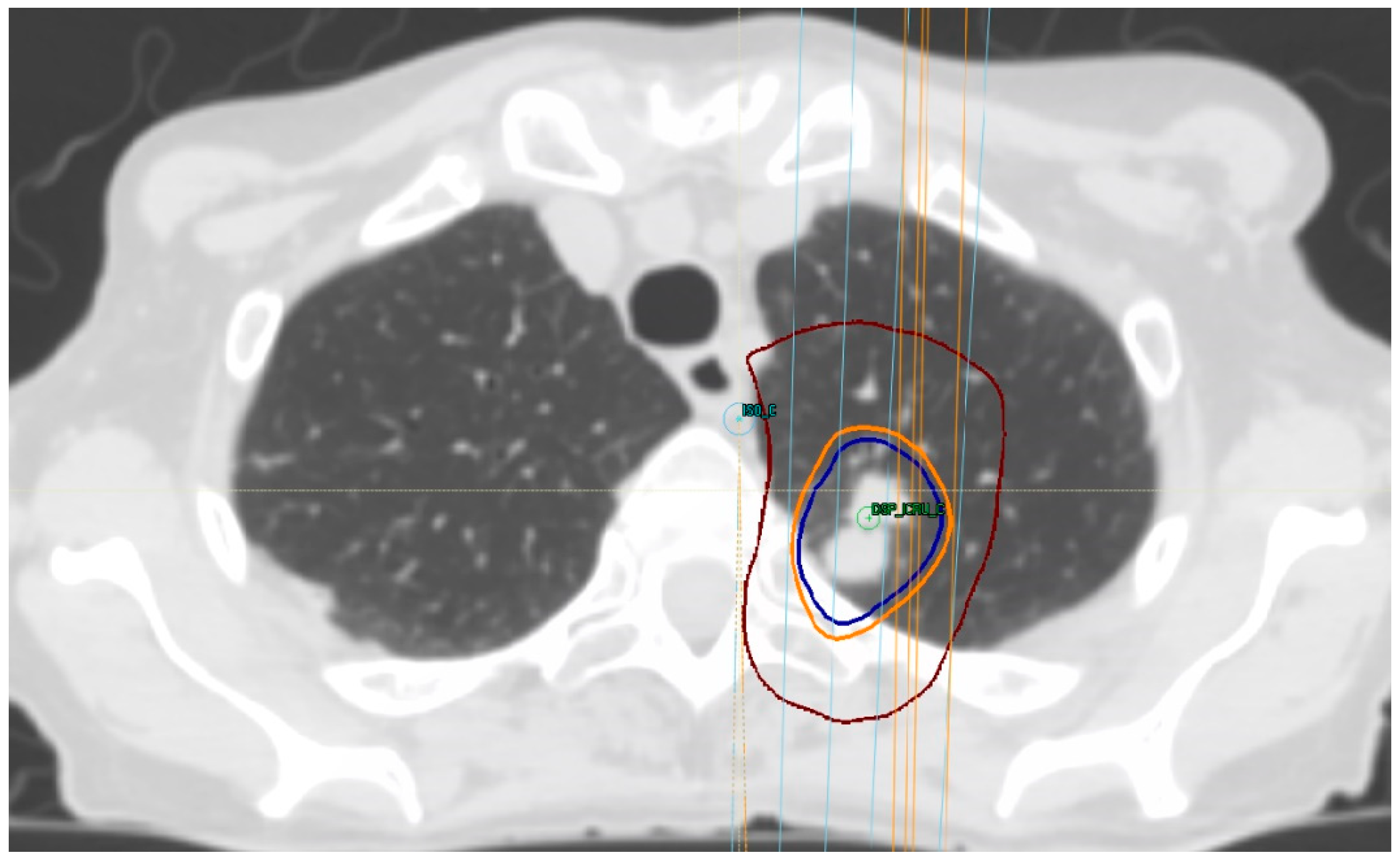 Curroncol 28 00233 g002 Curroncol 28 00233 g002