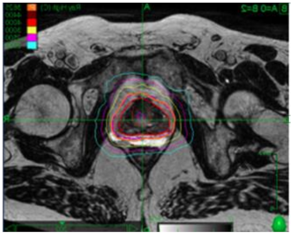 Curroncol 28 00257 g002