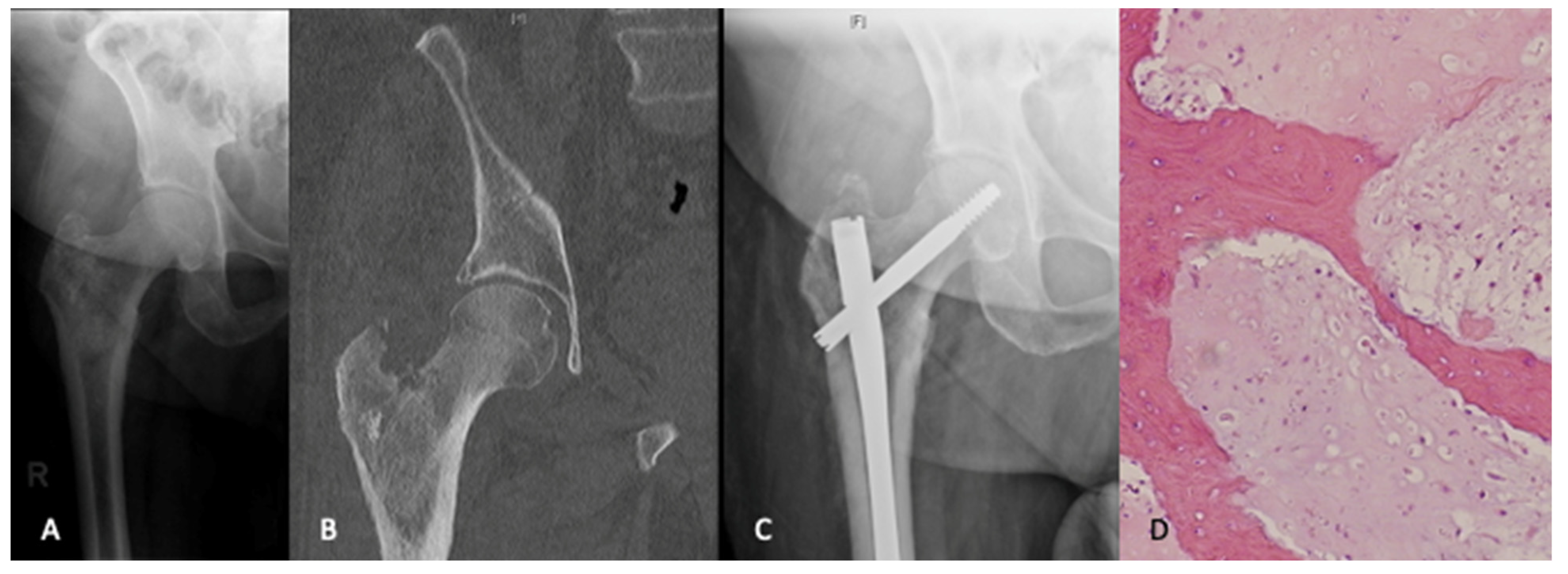 Curroncol 28 00320 g001 Curroncol 28 00320 g001