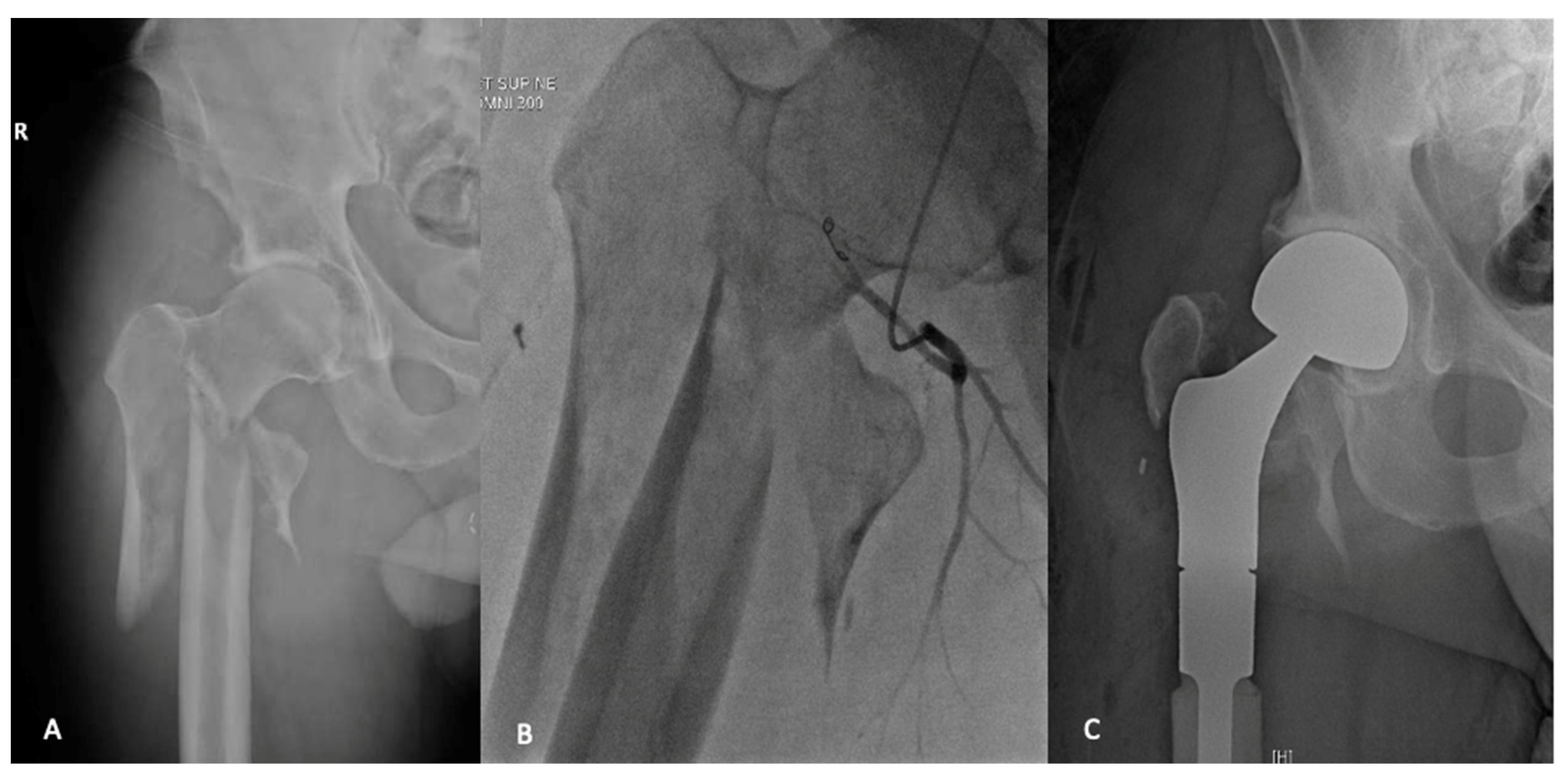 Curroncol 28 00320 g002 Curroncol 28 00320 g002