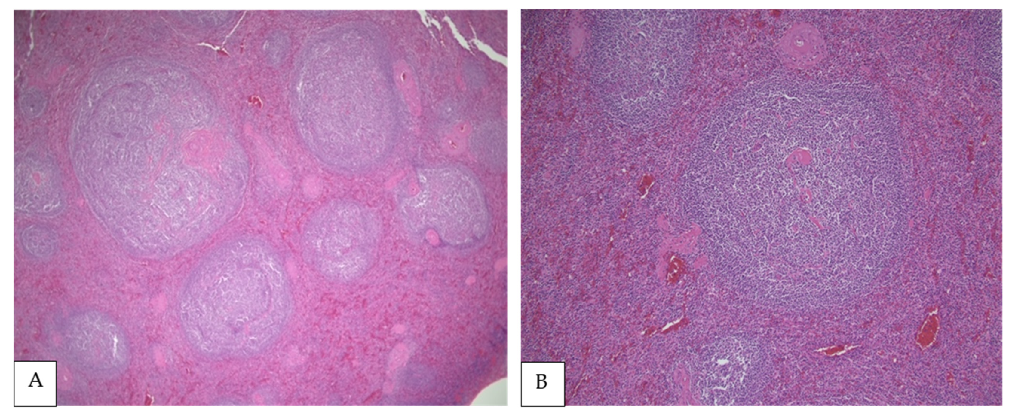 Curroncol 28 00407 g001a Curroncol 28 00407 g001a